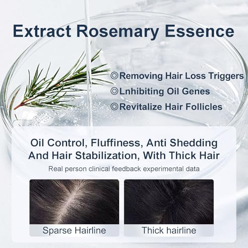 Organic Biotin Rosemary Hair Growth Shampoo for Women & Men- Thickening Shampoo with Amino Acid for Hair Loss-Dandruff Shampoo for Oily Hair and Scalp - Image 3