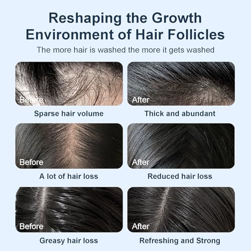 Organic Biotin Rosemary Hair Growth Shampoo for Women & Men- Thickening Shampoo with Amino Acid for Hair Loss-Dandruff Shampoo for Oily Hair and Scalp - Image 6