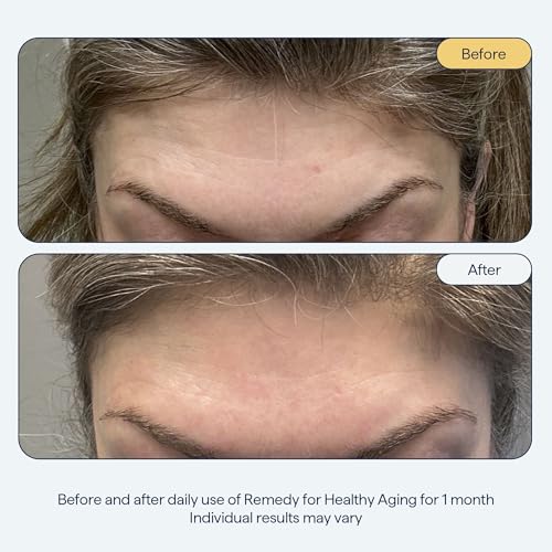 Remedy for Healthy Aging - Anti-Aging Treatment for Wrinkles, Uneven Texture & Tone with Retinaldehyde, Argireline, Matrixyl 3000, Glycolic Acid, Ferulic Acid - By Dermatologist Dr. Shah - Image 8