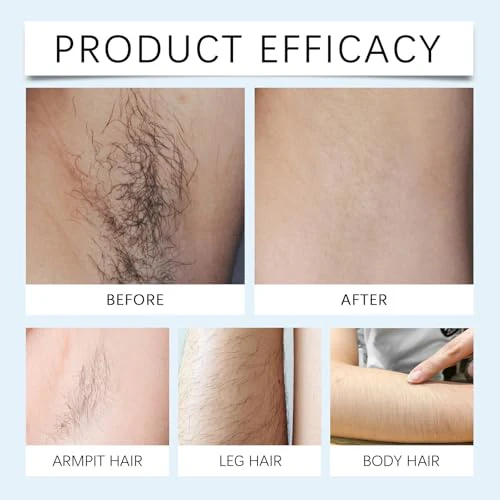 Cyperus Rotundus Oil, Cyprus Oil Natural Nut Grass Oil for Reducing Body Hair Growth, Smooth Skin & Hair Removal, Moisturizing & Soothing - Image 4
