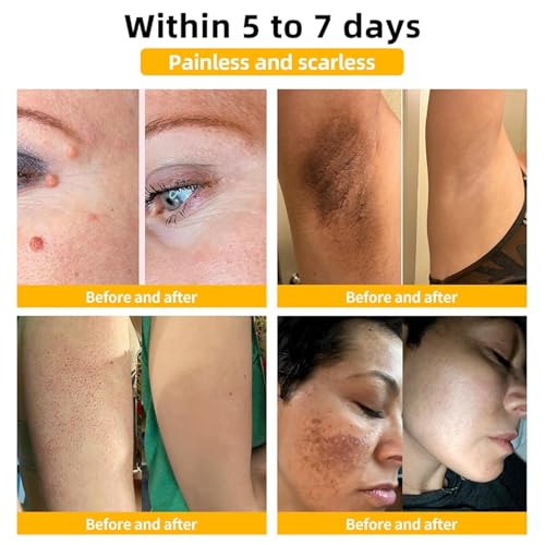 2PCS Bee Venom Cream, Bee Venom Skin Treatment Cream for Women, Bee Venom for All Skin Types - Image 3