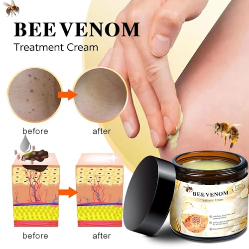 2PCS Bee Venom Cream, Bee Venom Skin Treatment Cream for Women, Bee Venom for All Skin Types - Image 4