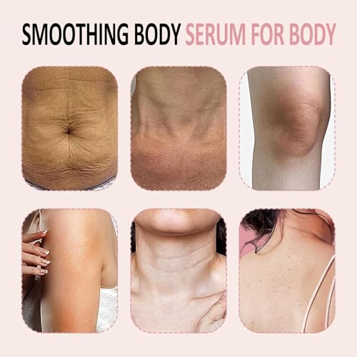 B Glossy Body Serum for Wrinkles, B Glossy Smoothing Body Serum for Wrinkles, Anti-Aging & Wrinkle Smoothing Formula, Infused with Hyaluronic Acid, Glycerin, Vitamin E, Hydrating & Firming 3.38FL.OZ - Image 3
