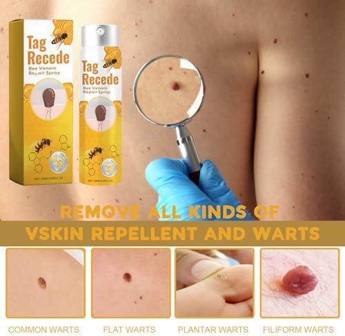 Tag Recede Bee Venom,2025 Tag Recede, TagRecede,Tag Recede Bee Venom Spray for All Skin Types(3PCS) - Image 3