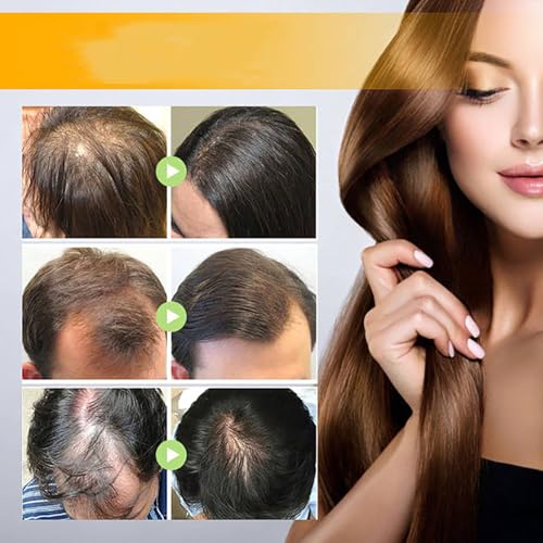 Onest Cosmetics Anti-Greying Hair Growth Oil, Onestcosmetics Anti Greying Hair Growth Oil Enriched with Amla and Sunflower,Onestcosmetic Rosemary Hair Oil Serum Anti Hair Loss Nourishing Serum - Image 2