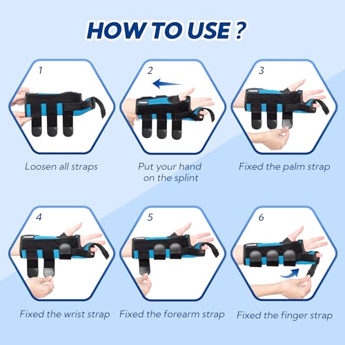 Boxer Fracture Splint, Ulnar Gutter Splint Right Hand, the 4th and 5th Metacarpal Finger Splint Hand Brace, Boxer Orthosis Hand & Wrist Brace for Women & Men, Left, M - Image 8