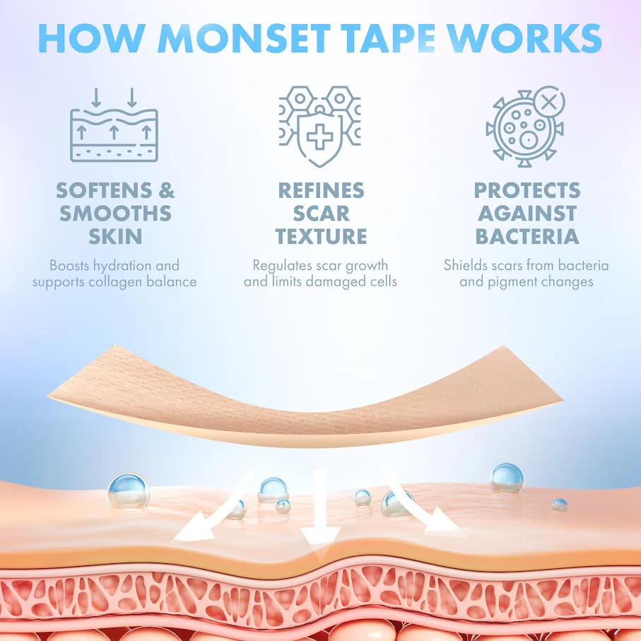 Silicone Scar Tape for Surgical Scars, Keloid, C-Section and More - Silicone Scar Sheets 130 x 1.5 inch - Effective Scar Treatment and Scar Removal for Face and Body - Silicone Tape for Scars - Image 7