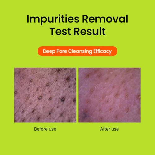beplain Mung Bean pH-Balanced Cleansing Foam | Scent-free Cleanser | Gentle & Moisturizing Face Wash for All Skin Types | Makeup Remover | Korean Skin Care (2.7fl.oz) - Image 4