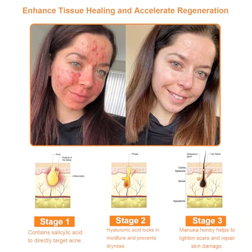 TLOPA Powerful All-Body Skin Treatment Cream, Professional Bee Venom Cream, Bee Venom Skin Therapy Cream, Natural Bee Venom Skin Treatment Cream for All Skin Types (2 Pack) - Image 5