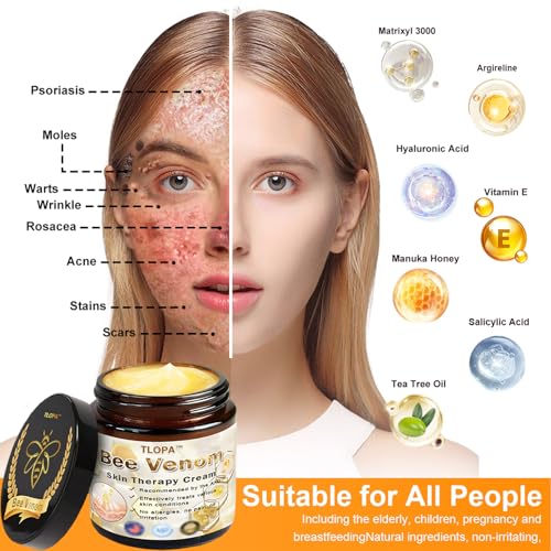TLOPA Powerful All-Body Skin Treatment Cream, Professional Bee Venom Cream, Bee Venom Skin Therapy Cream, Natural Bee Venom Skin Treatment Cream for All Skin Types (2 Pack) - Image 7