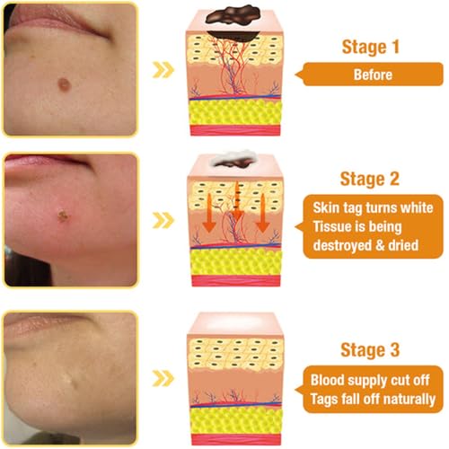 BBOJI 7-Day Multi-Effect All-in-One Skincare Cream, 2025 New Professional Bee Venom Cream, BOJI Bee Venom Skin Treatment Cream, Repair, moisturize and lift 3 in 1, for All Skin Types (1 Bottle) - Image 3