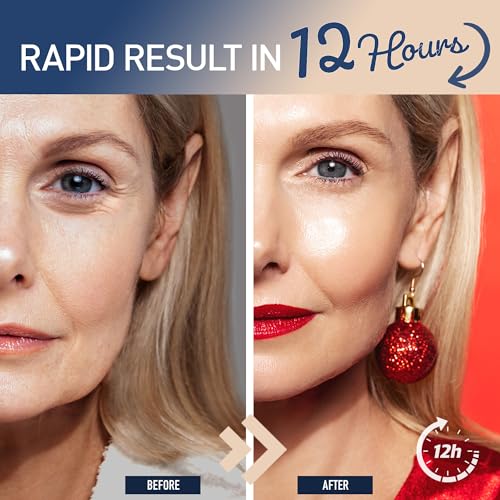 Enaskin Naturals Instant Anti Wrinkle Eye Cream: Rapid Temporay Eye Tightener for Dark Circles, Fine Lines and Puffiness in 60s, Anti Aging Under Eye Cream for Fine Lines and Eye Bags - Image 4