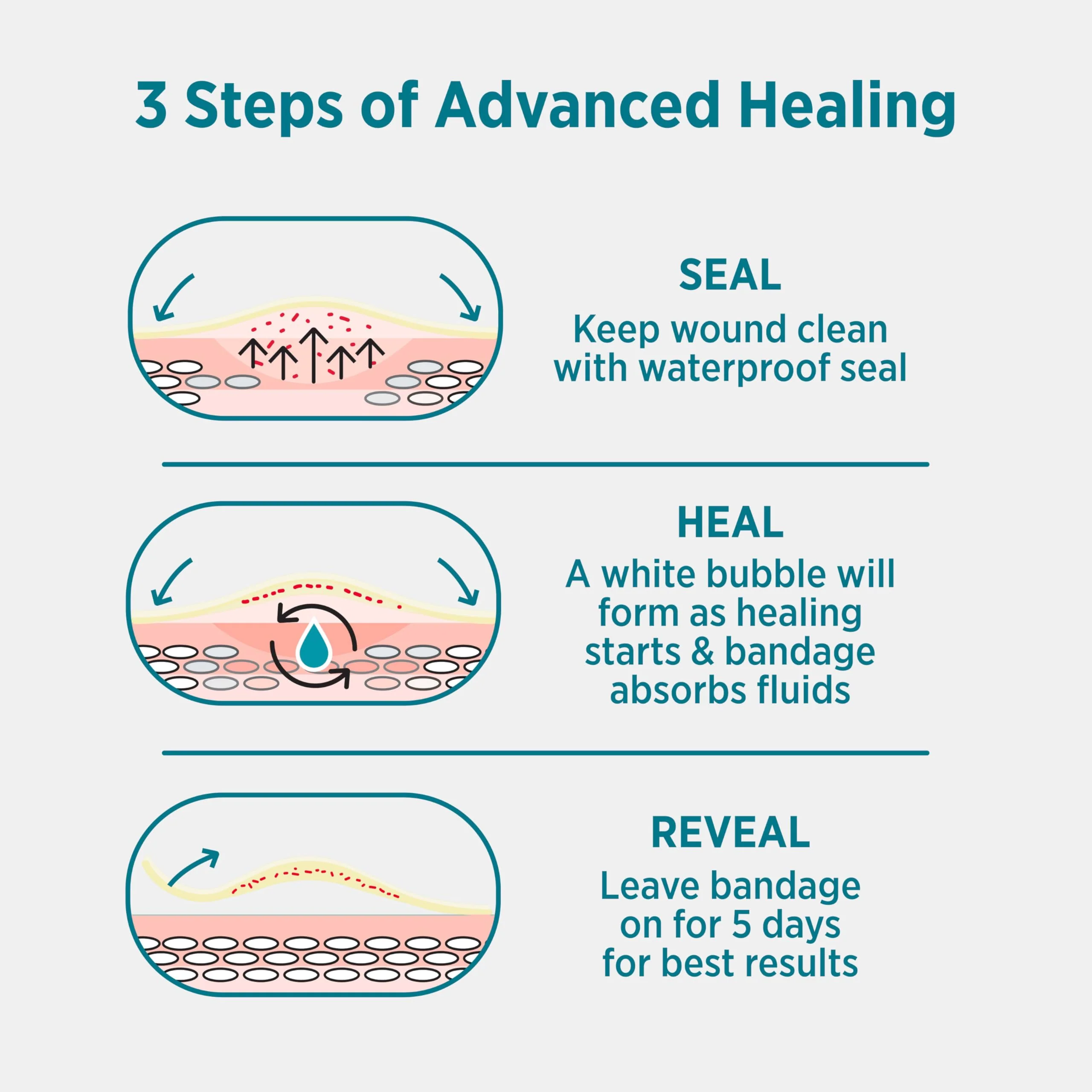 BAND-AID Brand Pro Heal 5 Day Protect, Ultra-Thin Hydrocolloid 100% Waterproof First Aid Adhesive Bandages for Advanced Healing and Less Scarring Versus Uncovered Wound, Large Size, 6 ct - Image 7