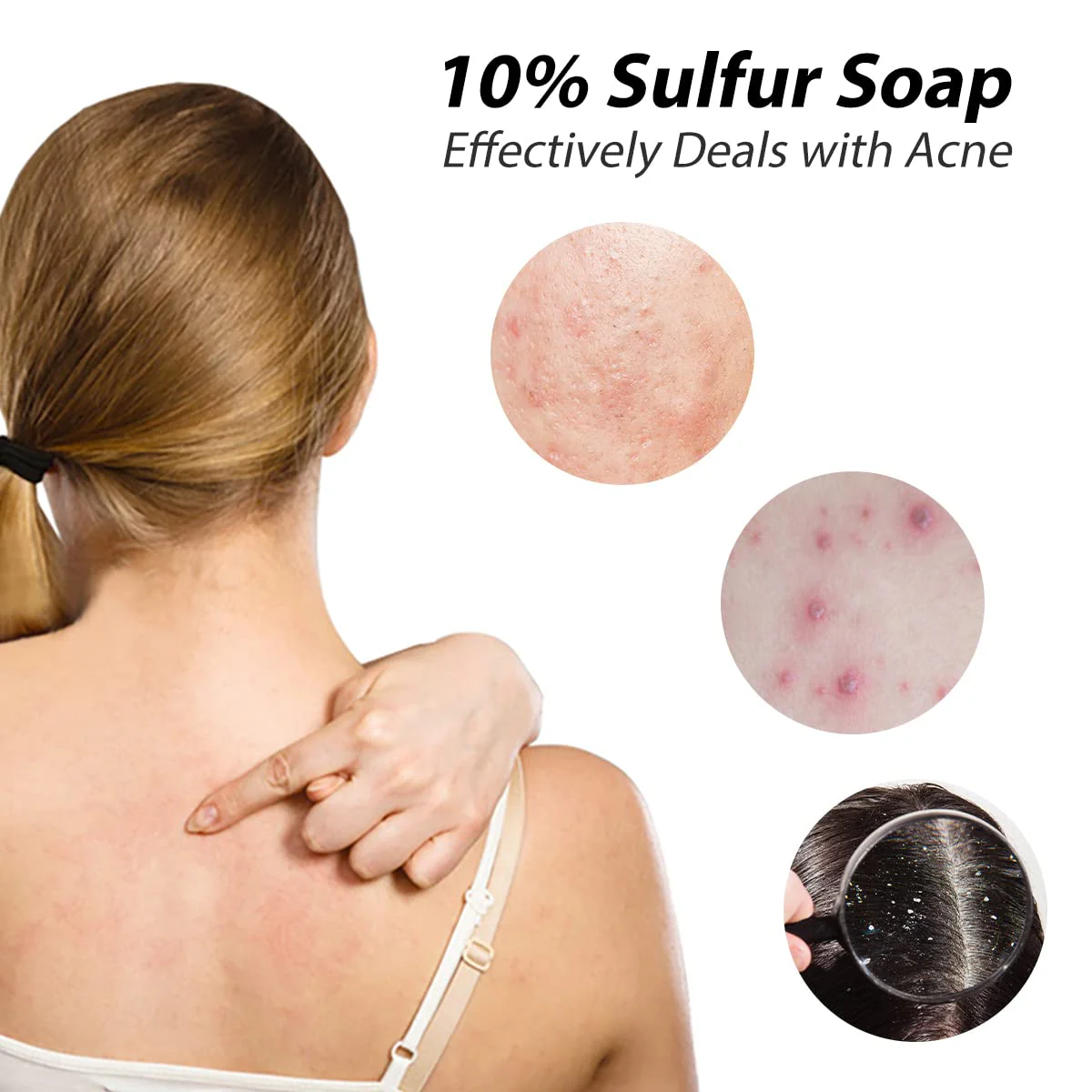 Bee & Flower Shanghai Sulfur Soap 10% Sulfur Soap Bar Face and Body Acne Treatment Sulphur Bar Soaps 3.4 Oz (6 Packs) - Image 2