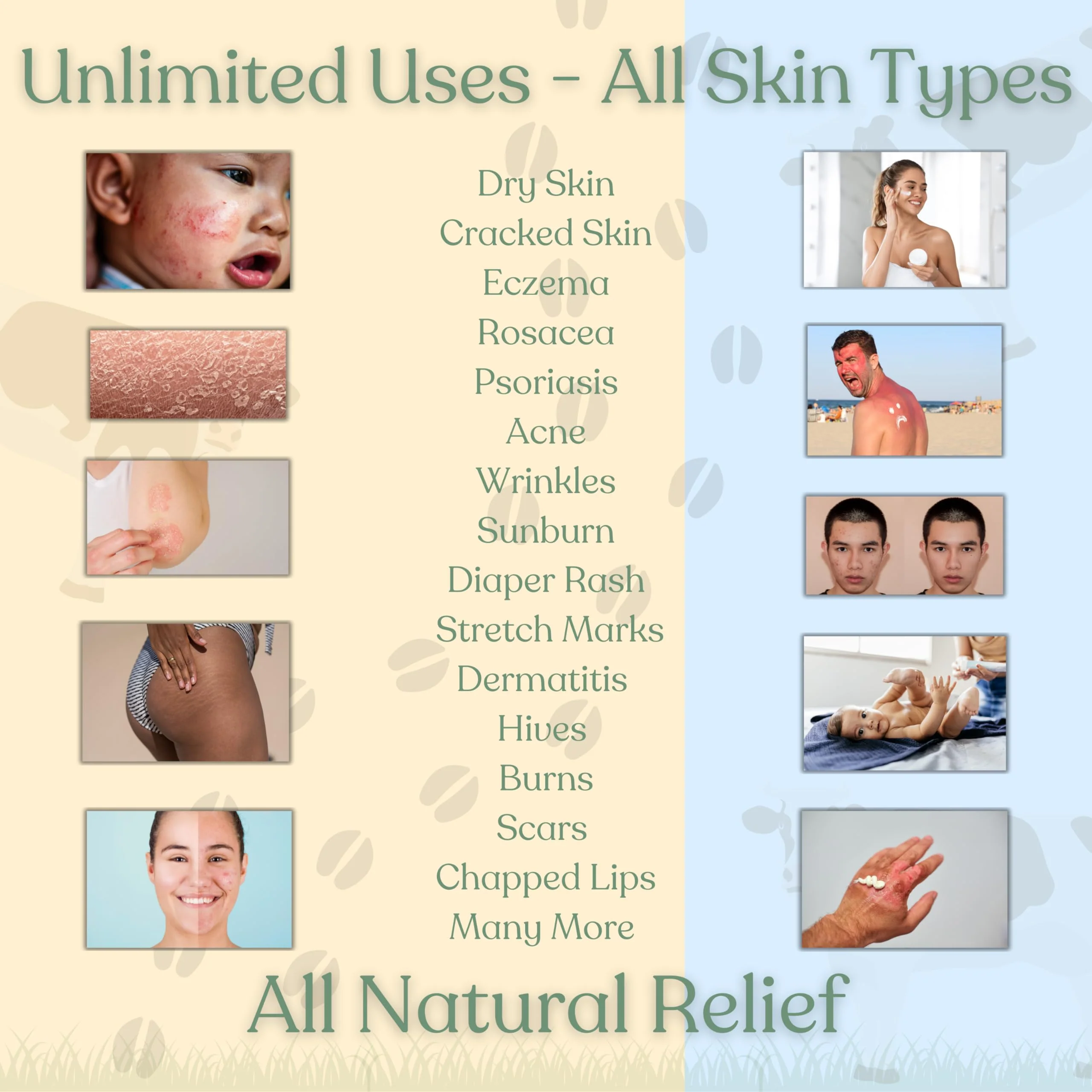 Beef Tallow for Skin - NAKED TALLOW BALM I 1 Ingredient - 100% Grass Fed Beef Tallow | Whole Body & Face | Whipped & UNSCENTED for Sensititve Dry Skin, Babies, Eczema, Psoriasis, Rosacea - Image 6