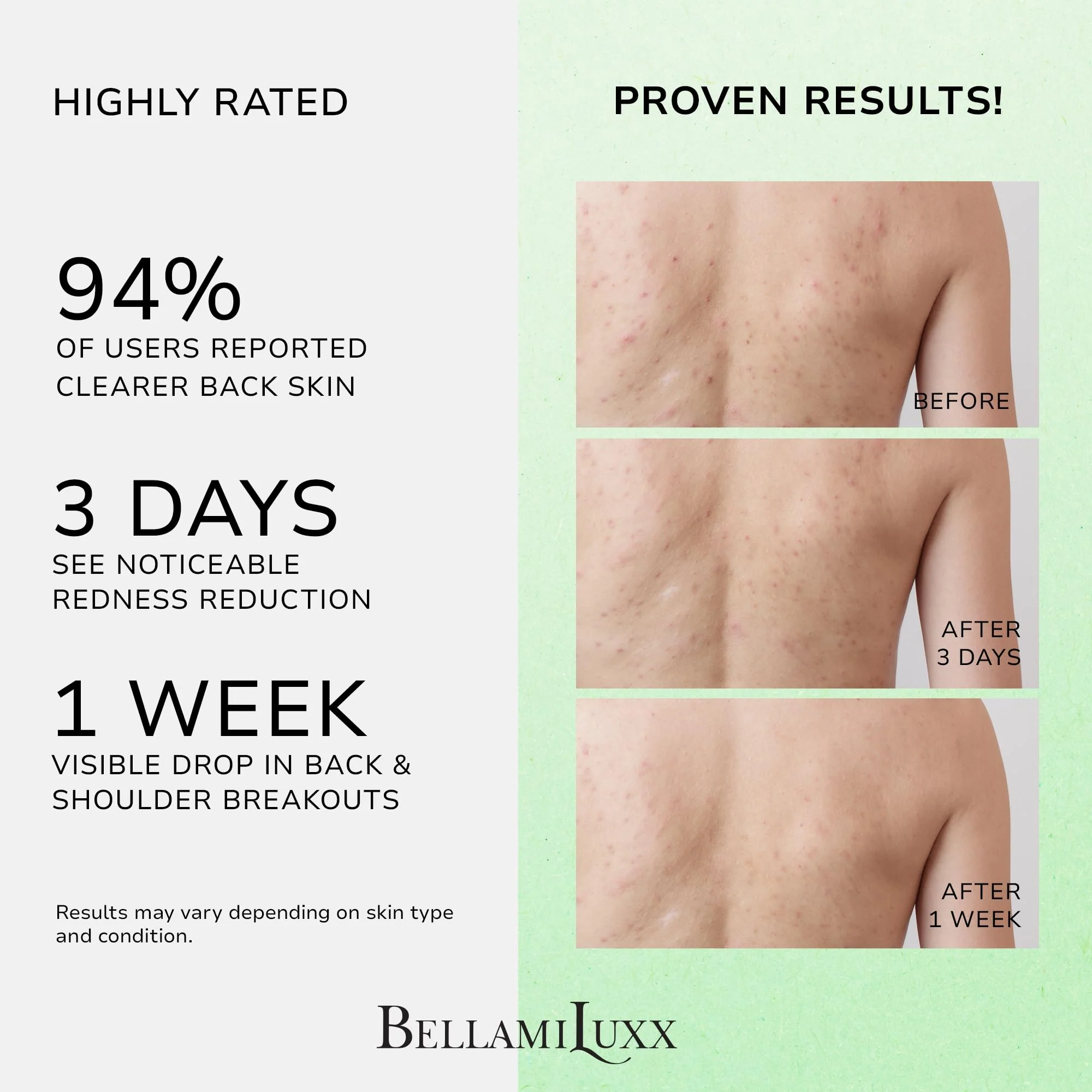 BellamiLuxx Back and Body Acne Treatment Spray: 2% Salicylic Acid & Tea Tree Oil Bacne Spray for Clear, Soothe & Moisturize - Effective for Men, Women, Teens with Back, Shoulder, Arm, and Chest Acne - Image 8