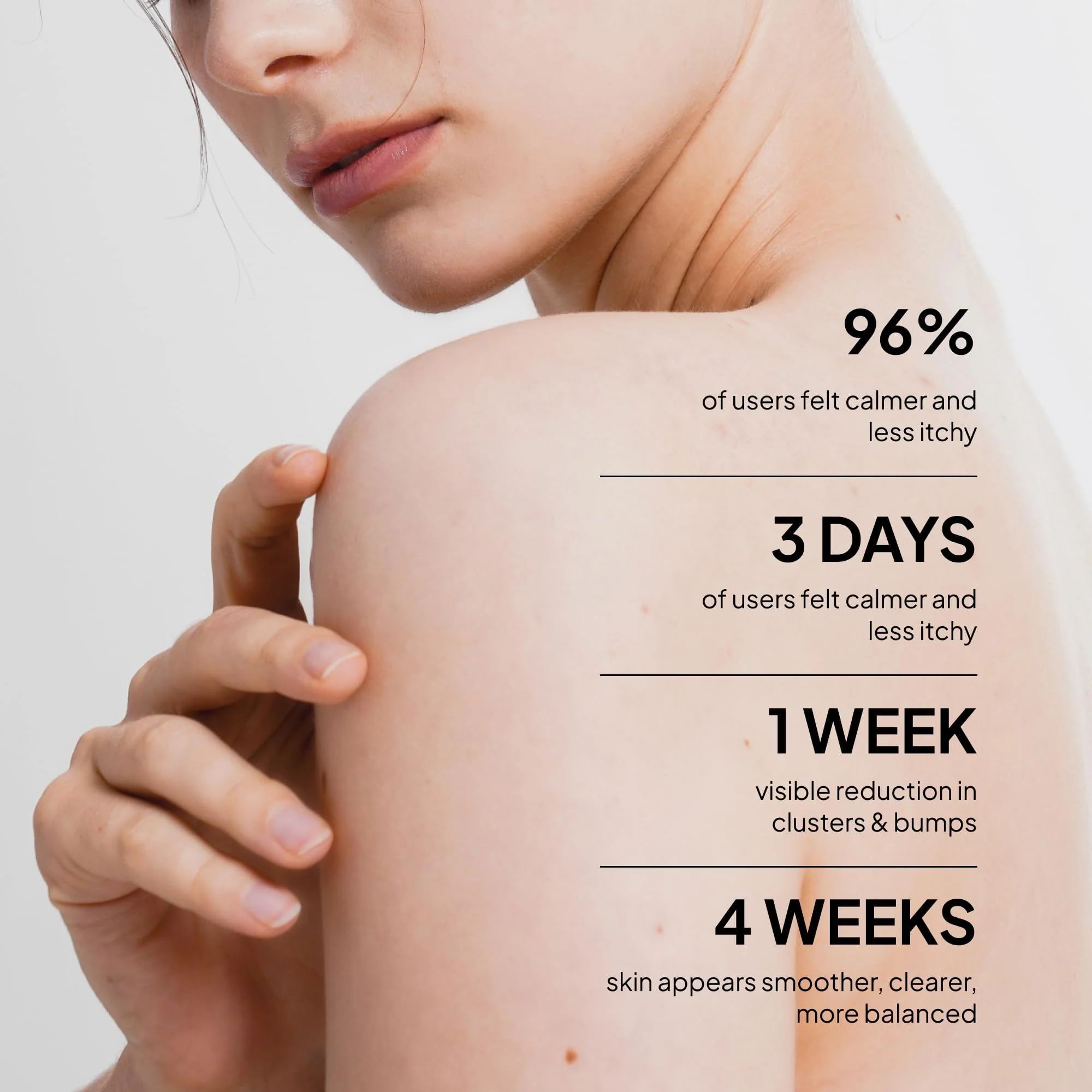 BellamiLuxx Fungal Acne Treatment Lotion: Effective Face & Body Pimple Cream for Bumps, Clusters, Itch & Redness – Fungal Prone Skin Acne Treatment Moisturizer for Teens & Adults with Natural Actives - Image 8