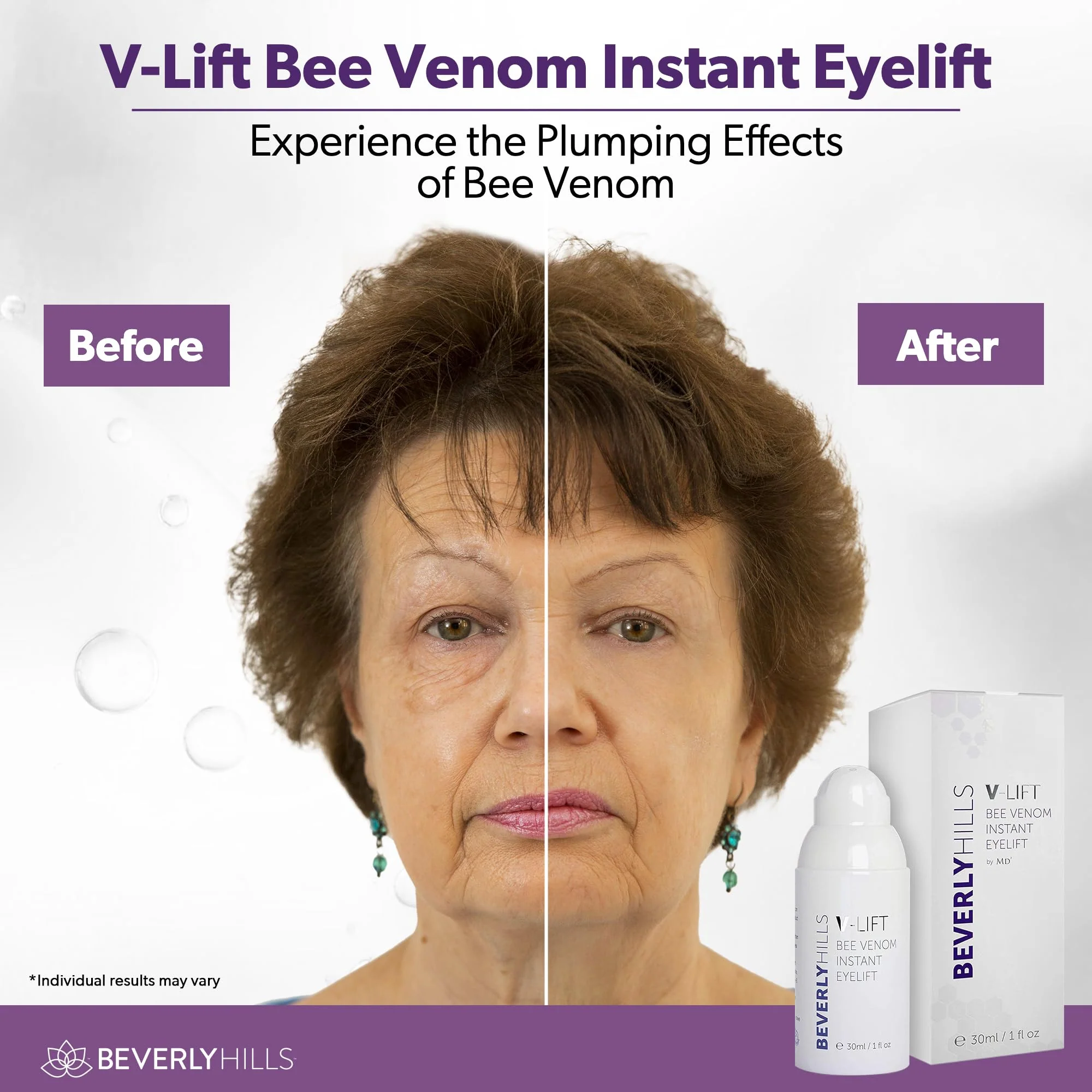 Beverly Hills V-Lift Instant Eye Lift and Eye Tuck Bee Venom Serum for Puffy Eyes, Dark Circles, Wrinkles, and Under Eye Bags Treatment for Women and Men | 30mL (120 Day Supply) - Image 6