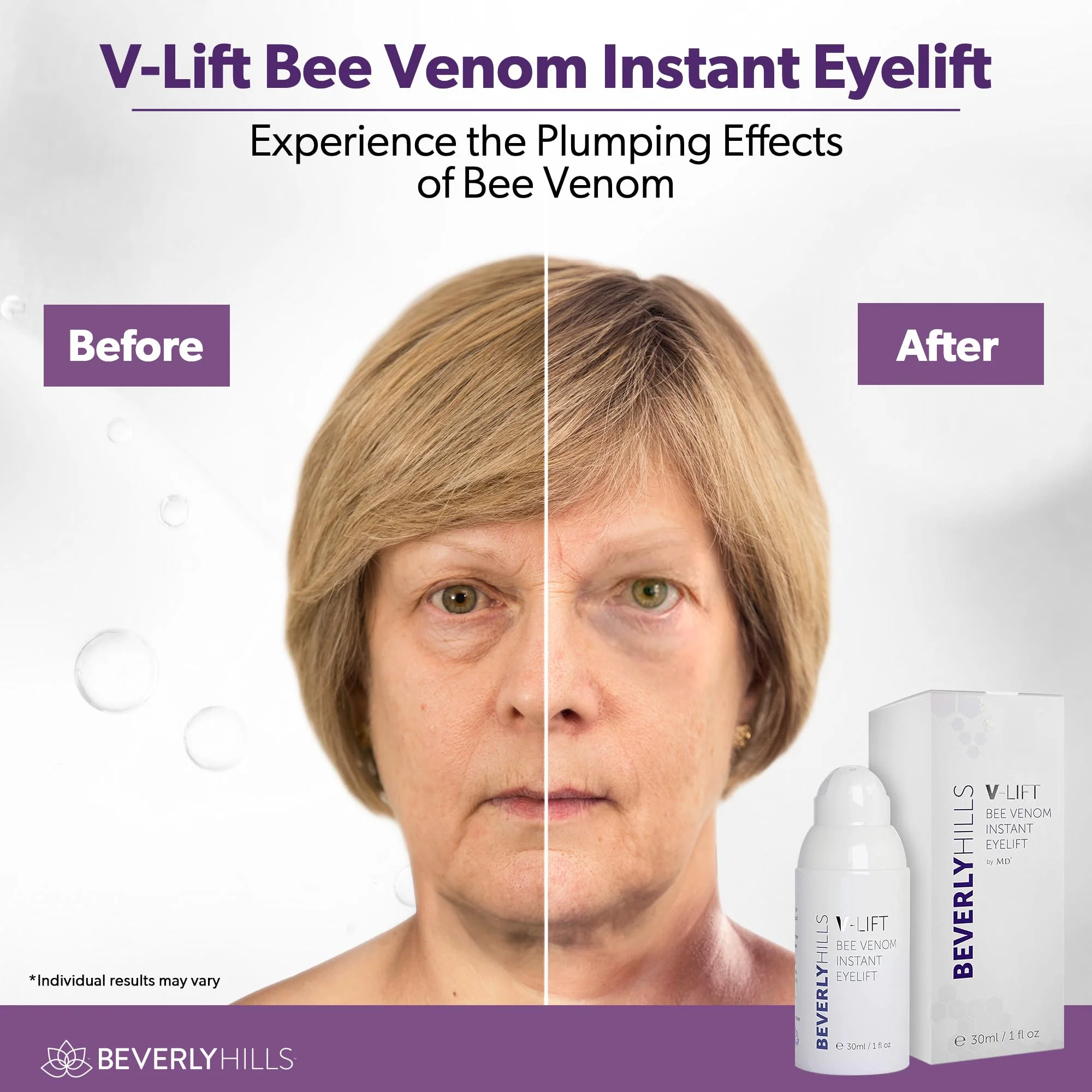 Beverly Hills V-Lift Instant Eye Lift and Eye Tuck Bee Venom Serum for Puffy Eyes, Dark Circles, Wrinkles, and Under Eye Bags Treatment for Women and Men | 30mL (120 Day Supply) - Image 8