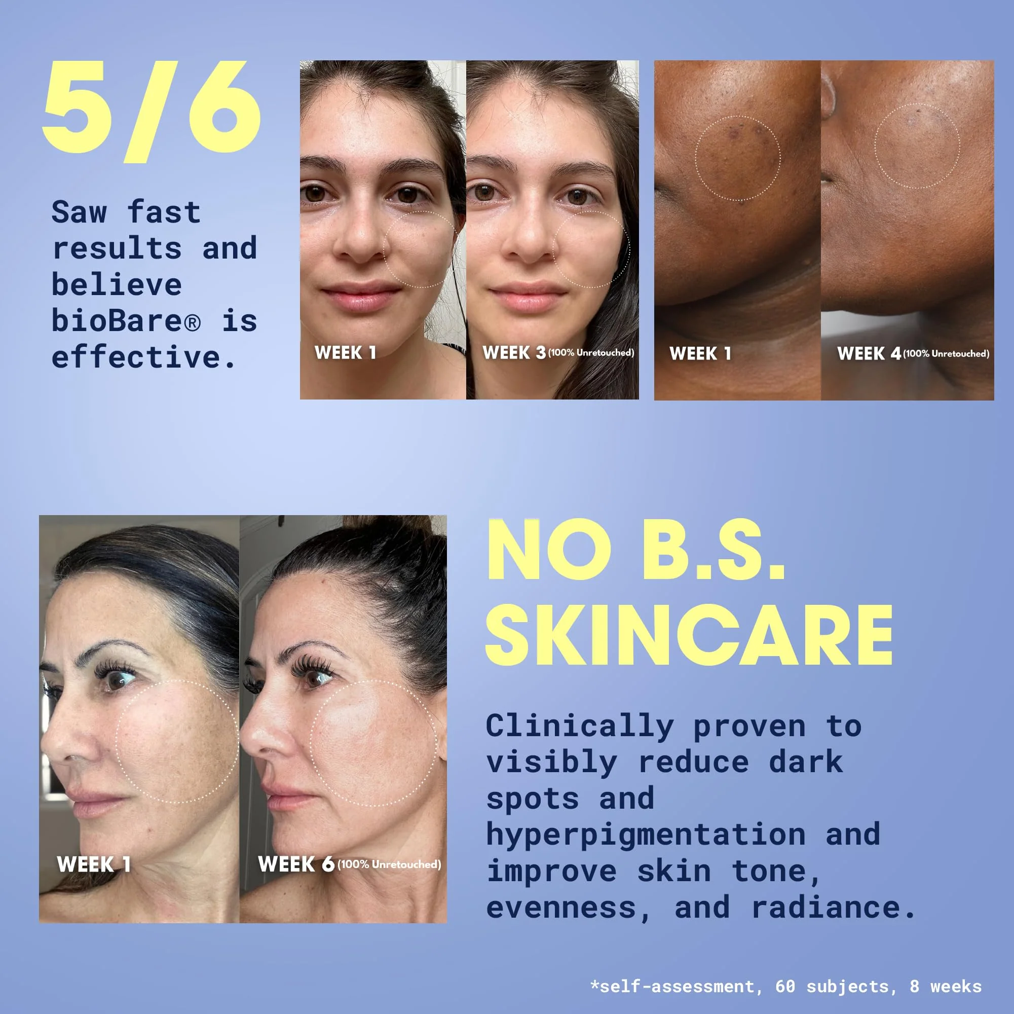 bioBare® Vitamin C, B, E & Ferulic Serum | 20% Pure Vitamin C Facial Serum with Hyaluronic Acid, Niacinamide & Ferulic Acid | L-Ascorbic Acid Serum for Dark Spots, Fine Lines, Wrinkles, Uneven Skin - Image 3