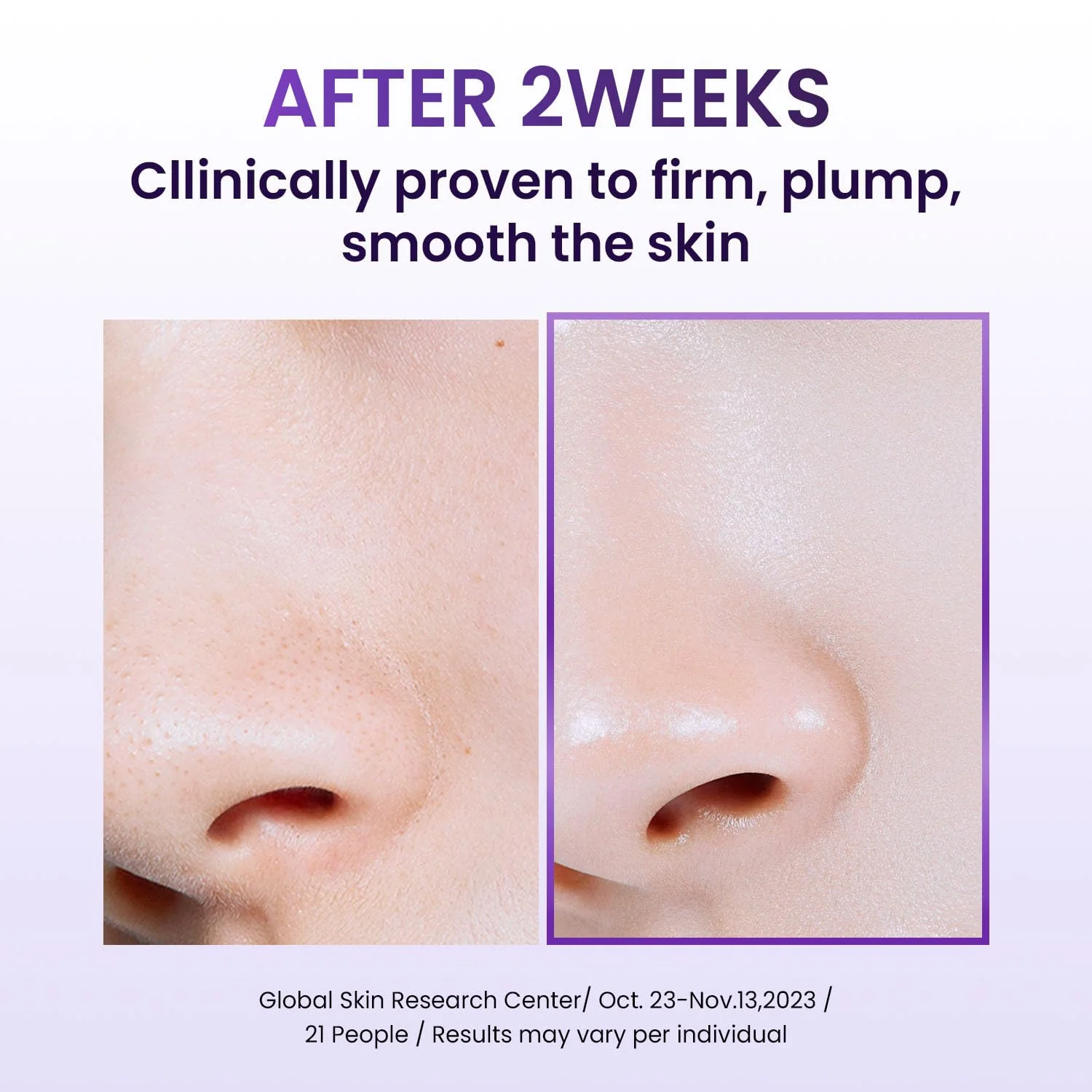 BIOHEAL BOH Probioderm™ Collagen Remodeling Cream 1.69 fl oz (50 ml) | Pore Tightening Cream with 150,000 Collagen Capsules for Firmness & Smooth Texture | Lightweight Moisturizer for Flawless Skin - Image 7
