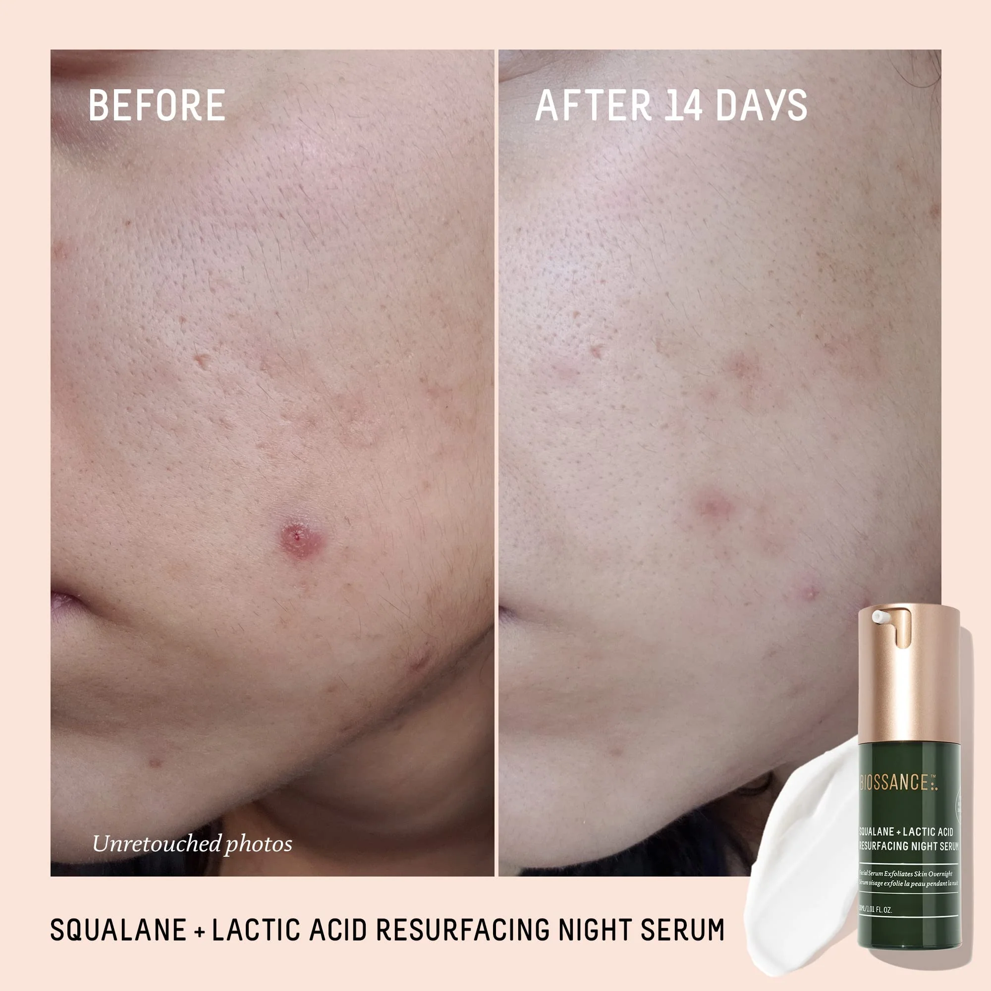 Biossance Squalane + Lactic Acid Resurfacing Night Serum - Vegan 10% Lactic Acid Face Serum for Skin Texture and Fine Lines - Gentle Night Exfoliant, Hydrating - Pore Reducer for Face, 1.0 Ounce - Image 3