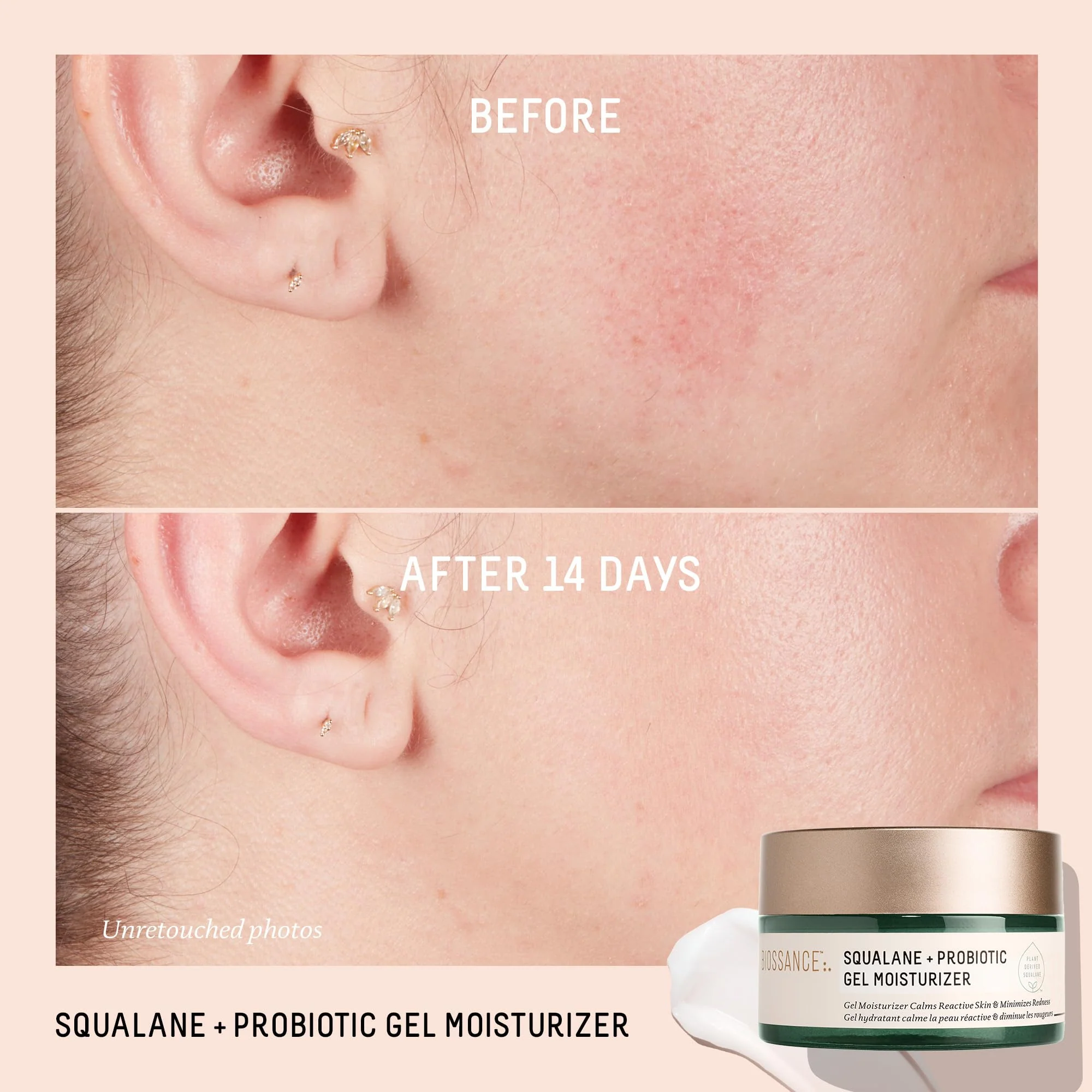 Biossance Squalane + Probiotic Balancing Face Gel Moisturizer - Advanced Formula for Oily & Acne-Prone Skin, Encapsulated Probiotics, Reduces Redness & Excess Oil, Soothes Sensitive Skin - 1.69 oz - Image 7