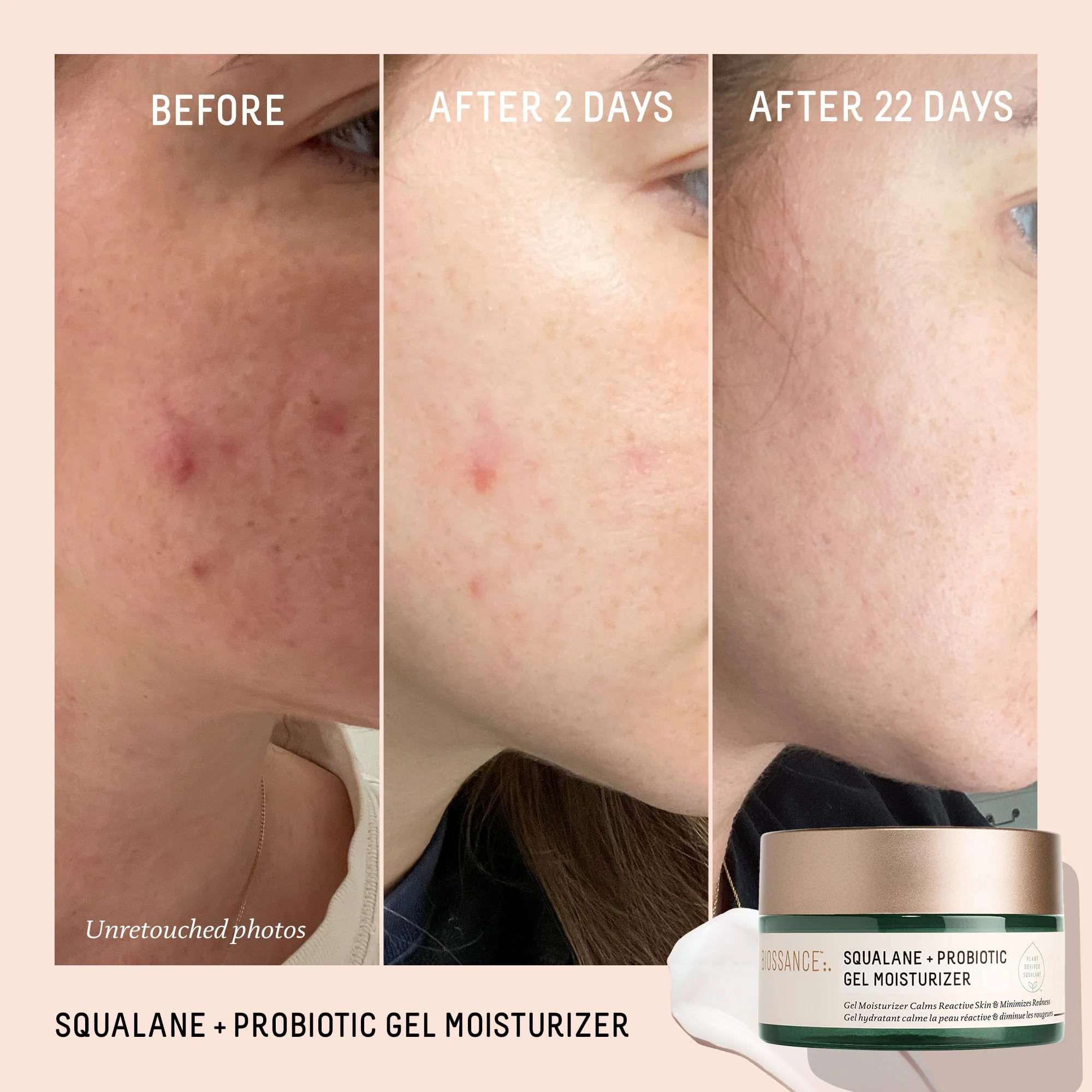 Biossance Squalane + Probiotic Balancing Face Gel Moisturizer - Advanced Formula for Oily & Acne-Prone Skin, Encapsulated Probiotics, Reduces Redness & Excess Oil, Soothes Sensitive Skin - 1.69 oz - Image 8