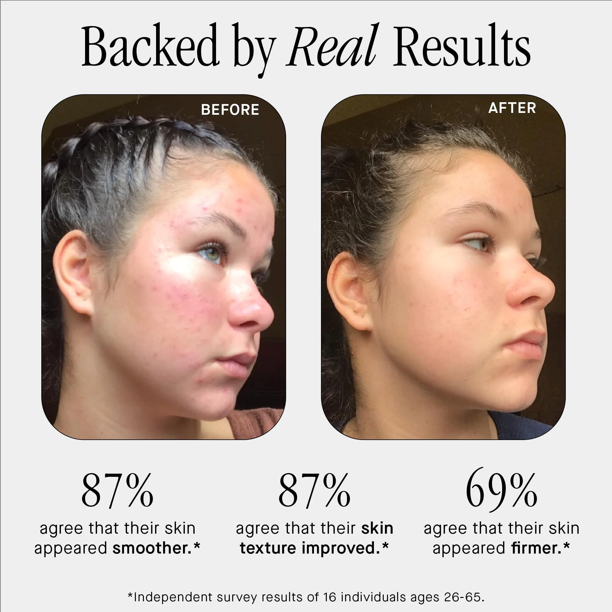 Brandefy No Needles - Niacinamide Serum, Peptides and Hyaluronic Acid. Hydrating & Plumping Serum for Bright, Smooth, Firm & Dewy Skin, 1oz, Made In The US - Image 6