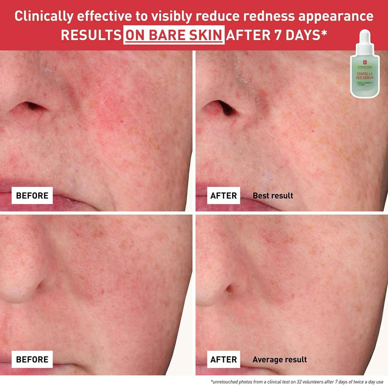 CENTELLA RED SERUM 30ML - Image 2
