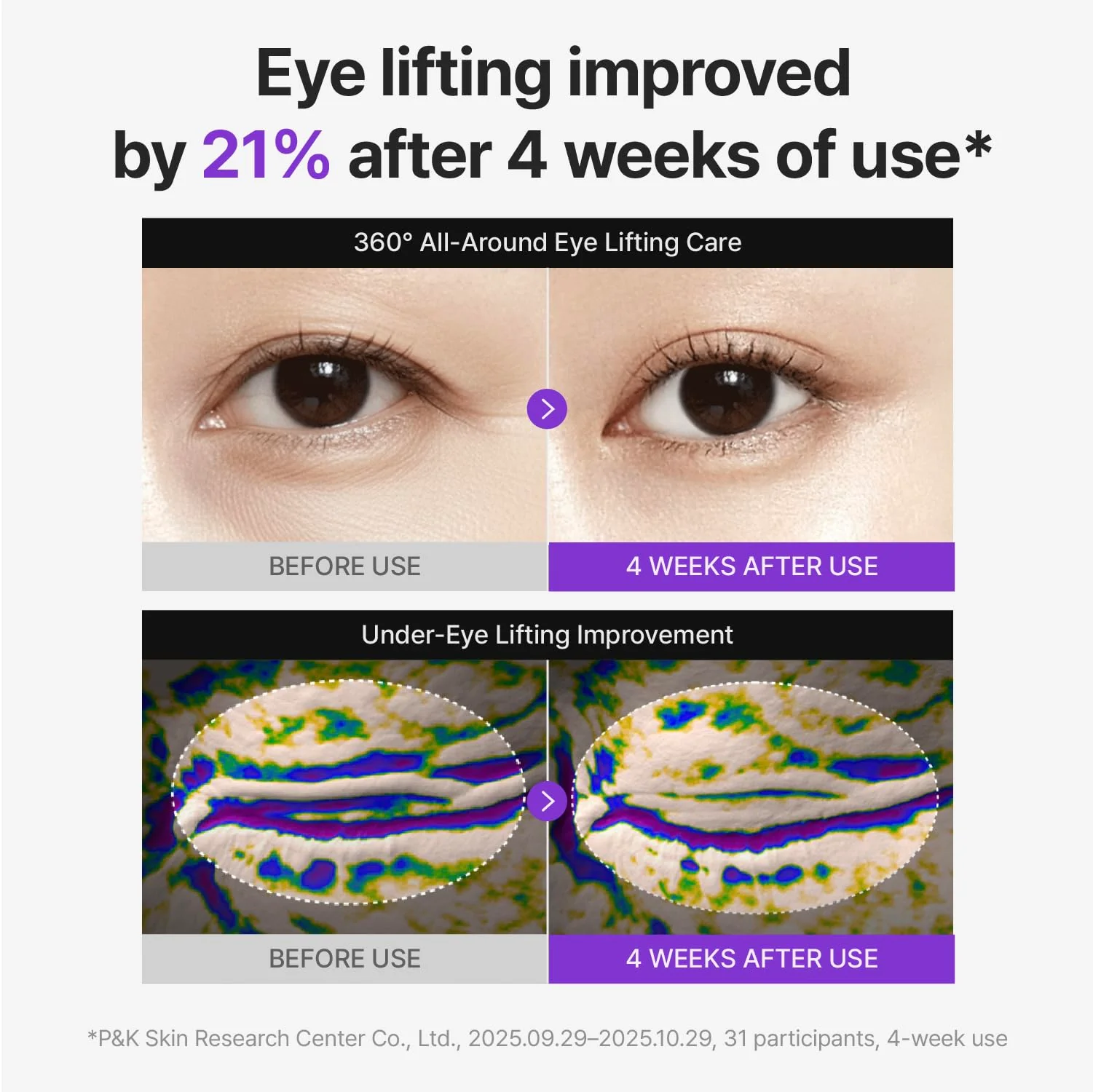 Centellian24 360 Shot PDRN Firming Eye Cream 30ml (1.01 fl oz) – Anti-Aging Retinol Eye Cream for Hooded Eyes, Wrinkle Smoothing, Firming Hydrating Care for Under-Eye Bags, Crow’s Feet & Dark Circles - Image 6