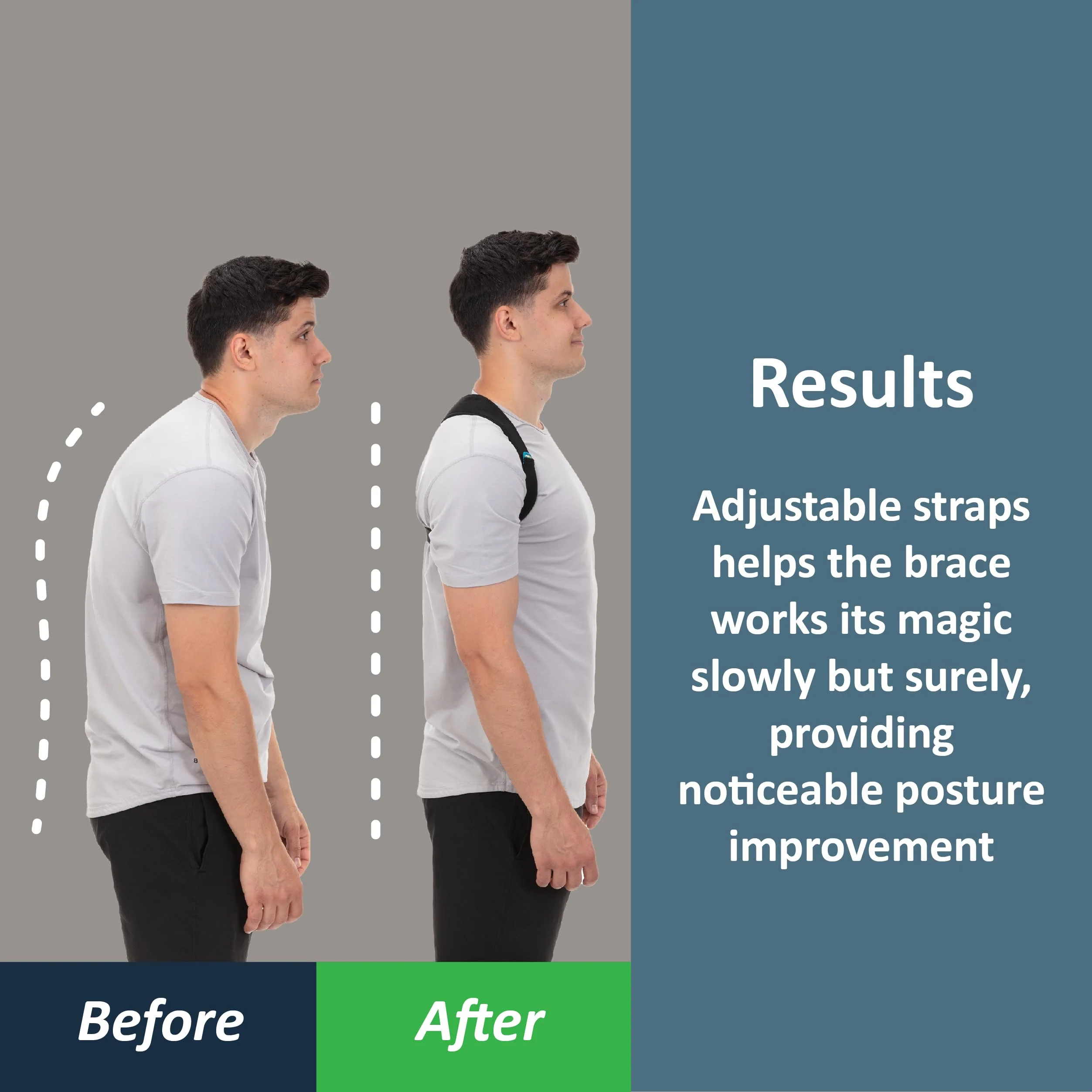 ComfyBrace Posture Corrector-Back Brace for Men and Women- Fully Adjustable Straightener for Mid, Upper Spine Support- Neck, Shoulder, Clavicle and Back Pain Relief-Breathable - Image 3