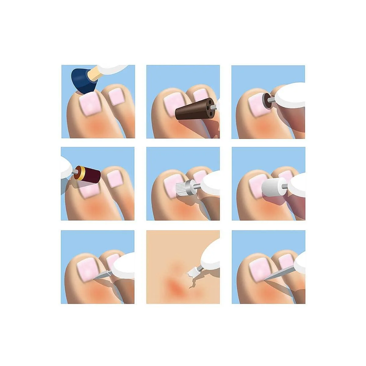 Coopers of Stortford - Long-Reach Nail Trimmer with Motorised with Extra-Long Shaft & 10 Interchangeable Precision Heads - Remove Calluses, File, Shape, and More - Easy Foot and Nail Care at Home - Image 4