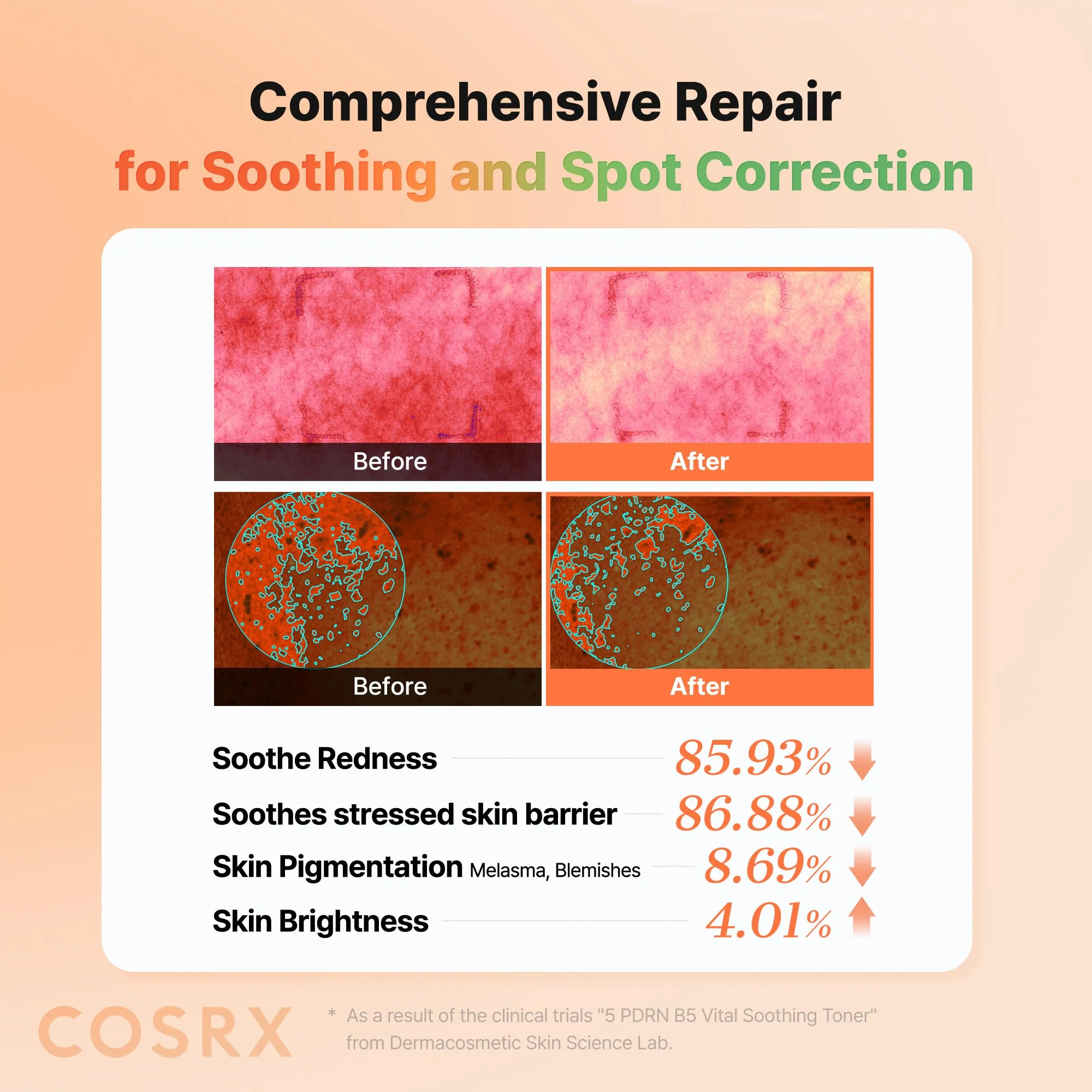 COSRX 5 PDRN B5 Vital Soothing Toner - Korean Toner for Rejuvenating & Soothing Skin with Salmon DNA, Centella, Lactobacillus PDRN & Panthenol, Korean Skin Care (280ml/9.46 fl.oz.) - Image 4