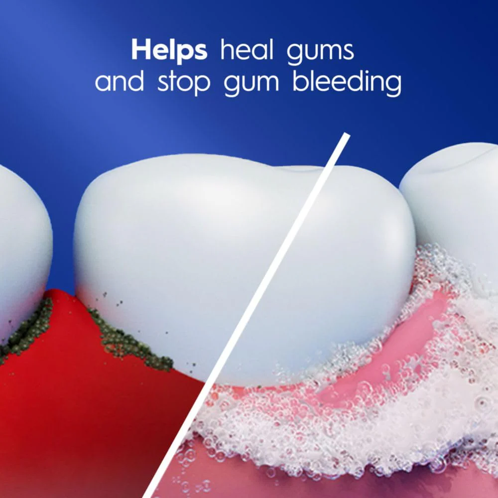Crest Pro-Health Gum Detoxify Deep Clean Toothpaste, 4.8 oz Pack of 24 - Anticavity, Antibacterial Flouride Toothpaste, Clinically Proven, Gum and Enamel Protection, Plaque Control - Image 4