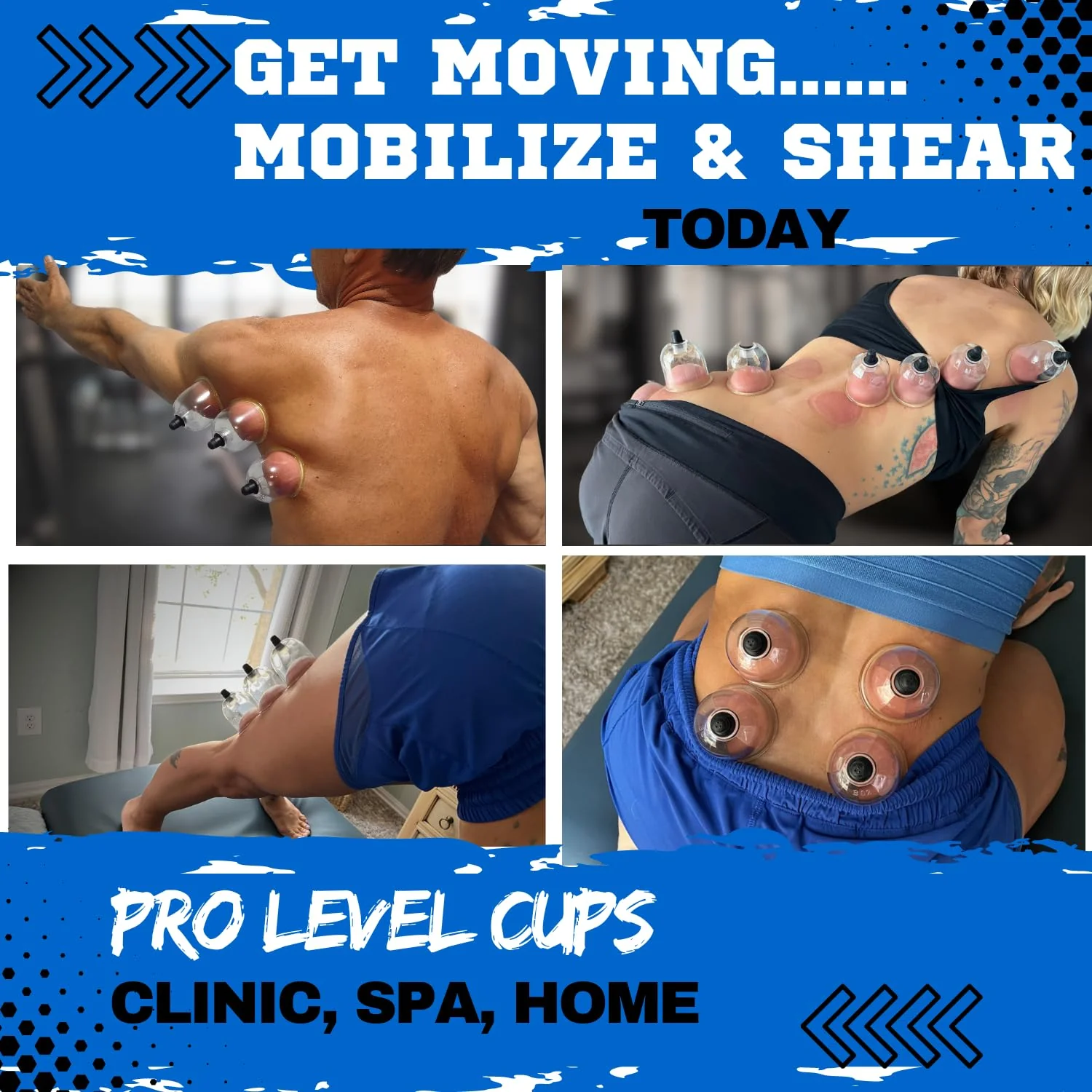 Cupping Warehouse TM Cupping Warehouse 20 Poly Professional Cupping Therapy Set – 20 Vacuum Cups with Pump Gun, Extension Tube for Massage Therapy, Myofascial Release, Pain Relief - Image 4