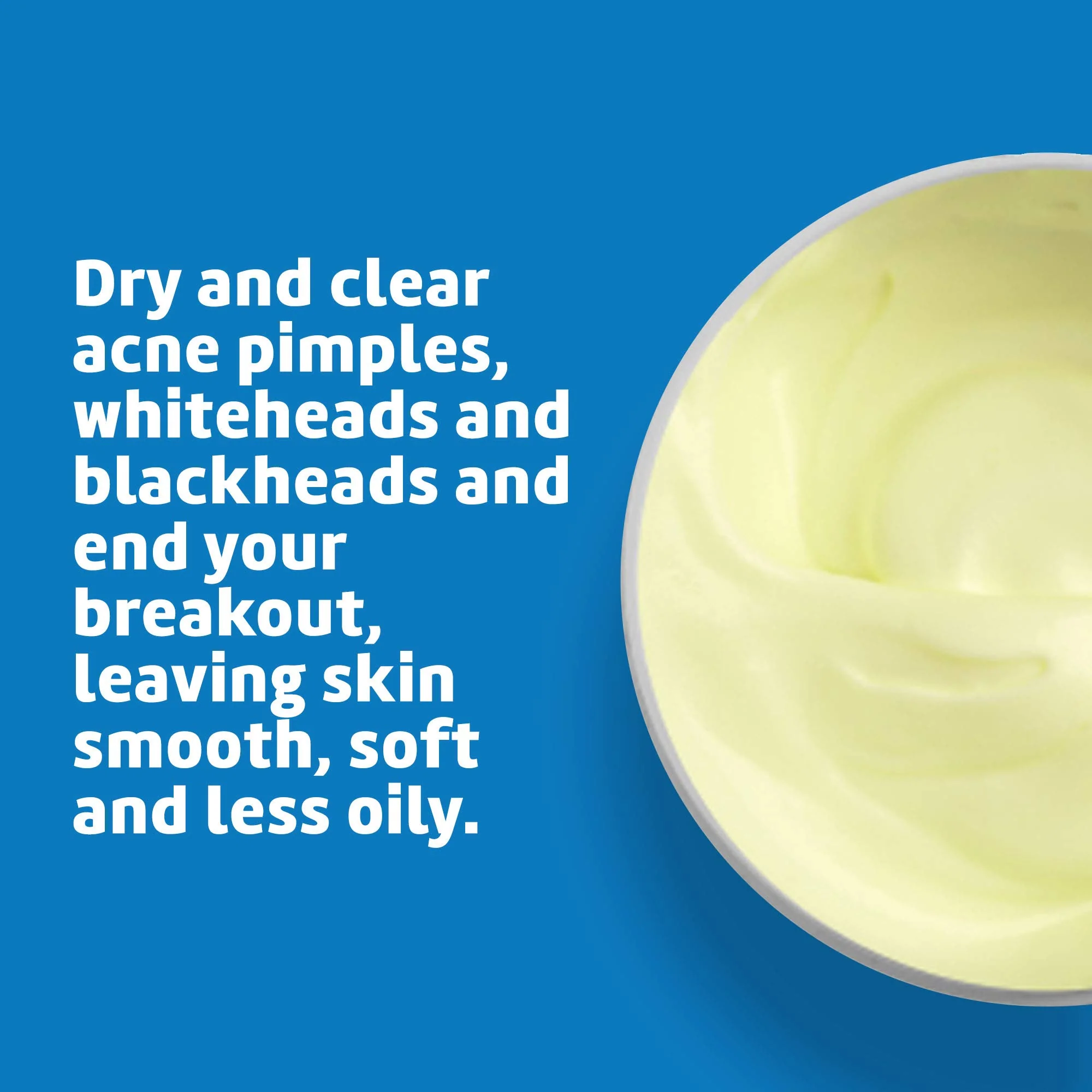 De La Cruz 10% Sulfur Ointment - Cystic Acne Treatment for Face and Body - Daily 10 Min Spot Treatment Mask - Safe and Effective Game Changing Hormonal Acne Treatment that Clears Up Pimples - 2.6 oz - Image 4