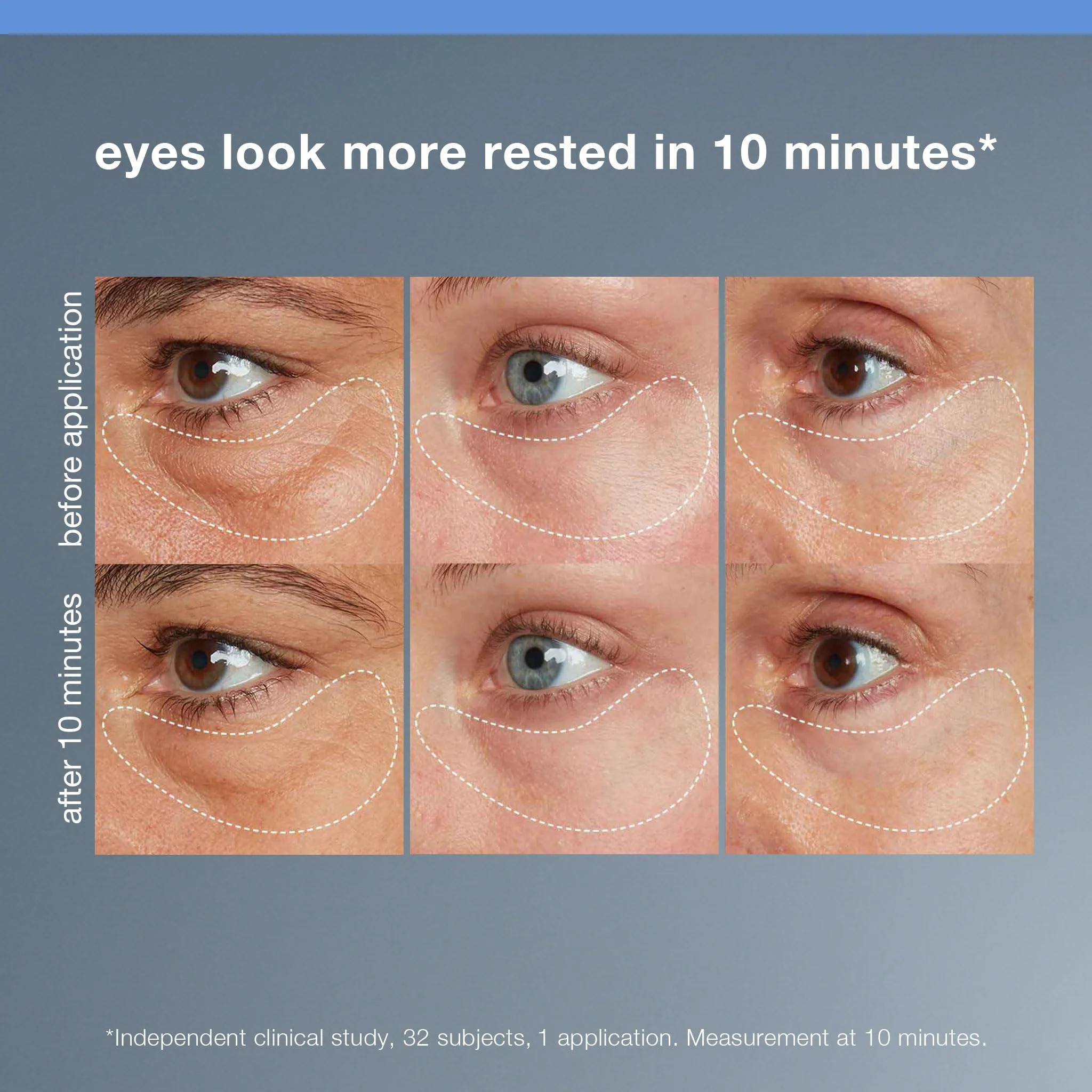 Dermalogica Awaken Peptide Eye Gel - Quickly Reduces the Appearance of Puffiness and Wrinkles - Image 9