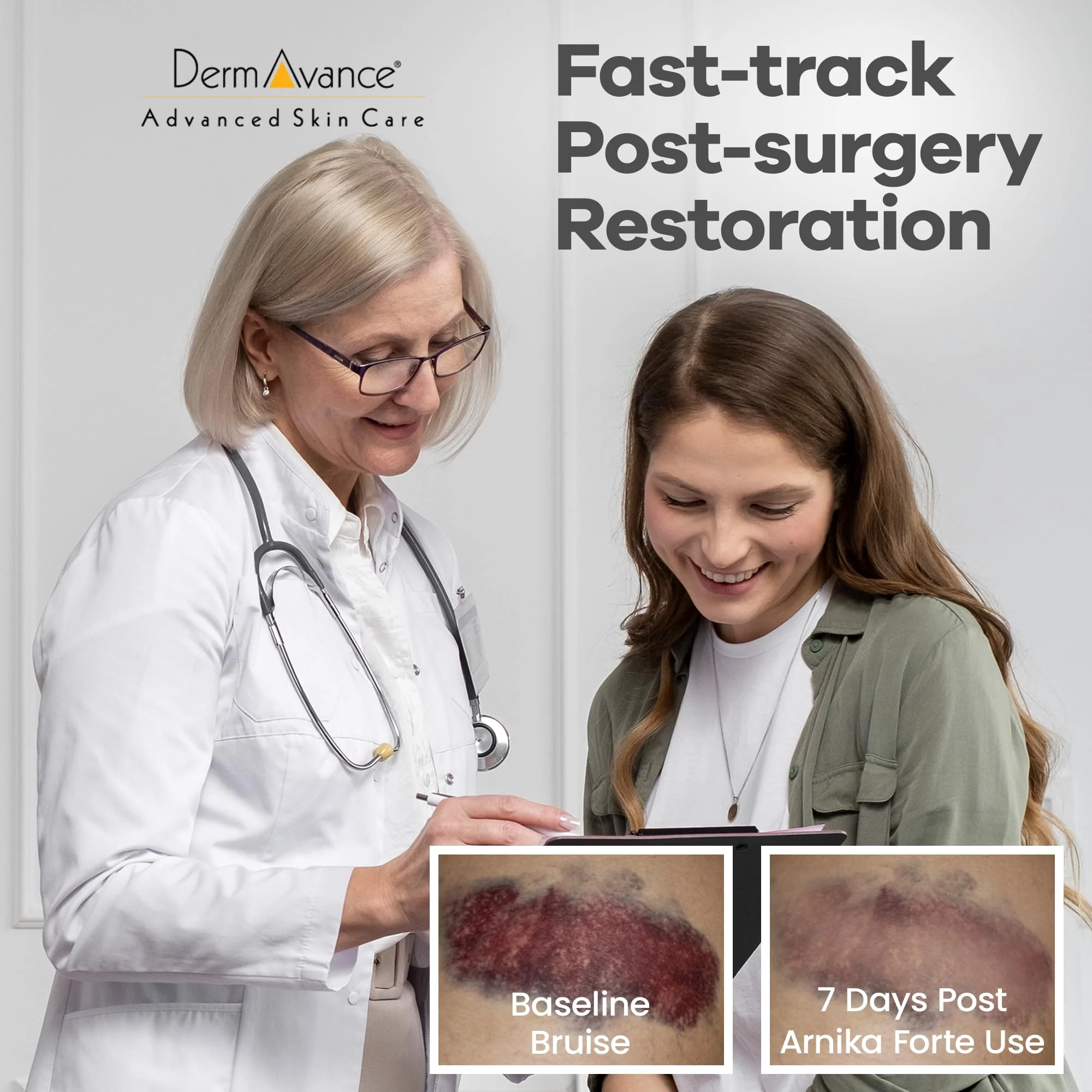 DermAvance Arnika Forte Capsules – Swelling and Bruising Reducer After Surgery and Aesthetic Treatments, Antioxidants & Bioflavonoids, Arnica 1000mg, Bromelain 125mg 3000GDU - 14 Capsules - Image 5