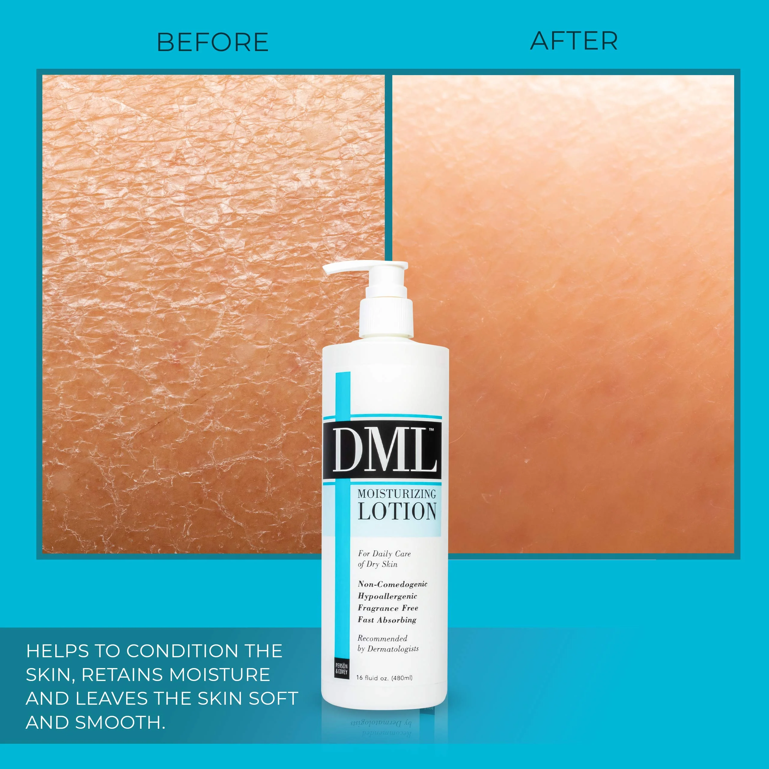 DML Moisturizing Lotion, 16 Fl Oz - Image 7