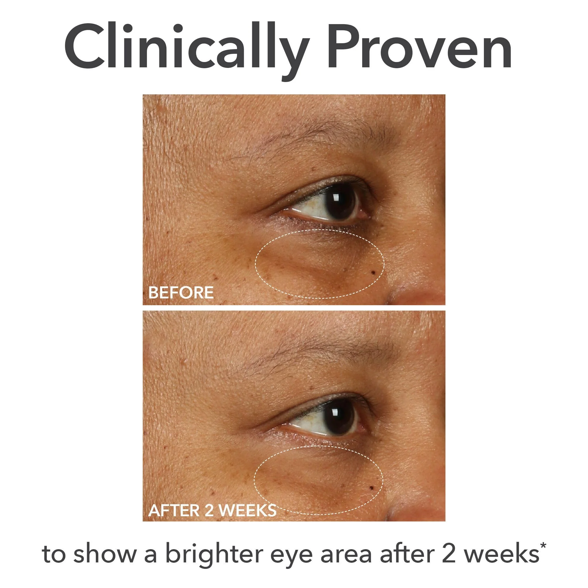 Dr Dennis Gross DermInfusions Fill + Repair Eye Cream: Hydrating & Brightening Treatment for Dark Circles, Fine Lines & Wrinkles, Firms & Smooths 360° Eye Area, 0.5 Oz - Image 8