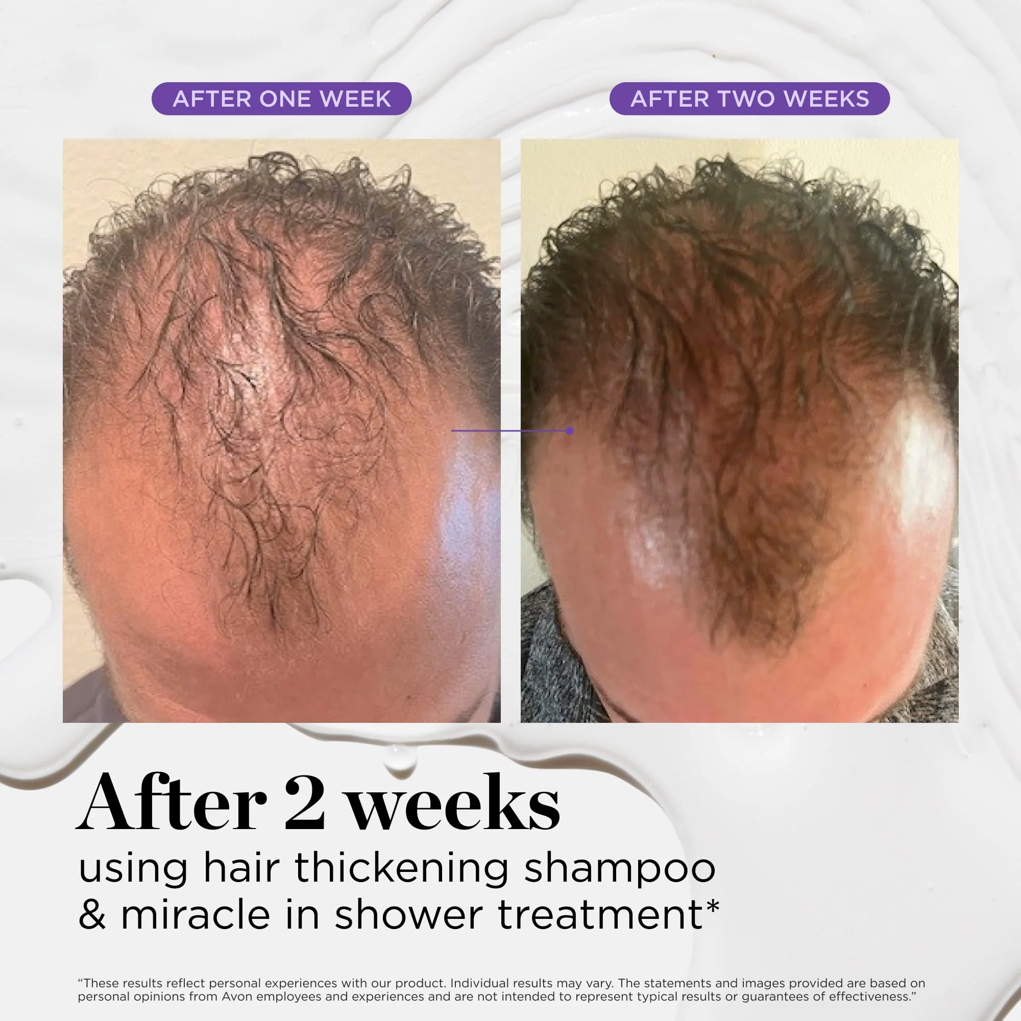 Dr. Groot Miracle in Shower Treatment for Hair Loss - Korean Care 5-Second Smoothing Solution With Rosemary Oil, Moisturizing Scalp Revitalizing Rinse - Image 3