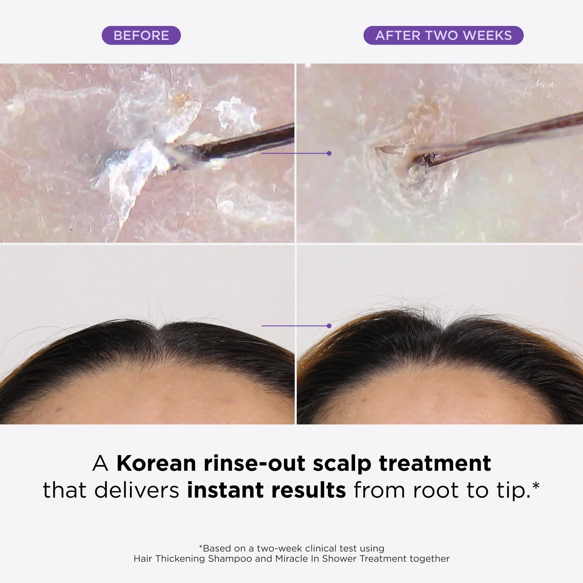 Dr. Groot Miracle in Shower Treatment for Hair Loss - Korean Care 5-Second Smoothing Solution With Rosemary Oil, Moisturizing Scalp Revitalizing Rinse - Image 9