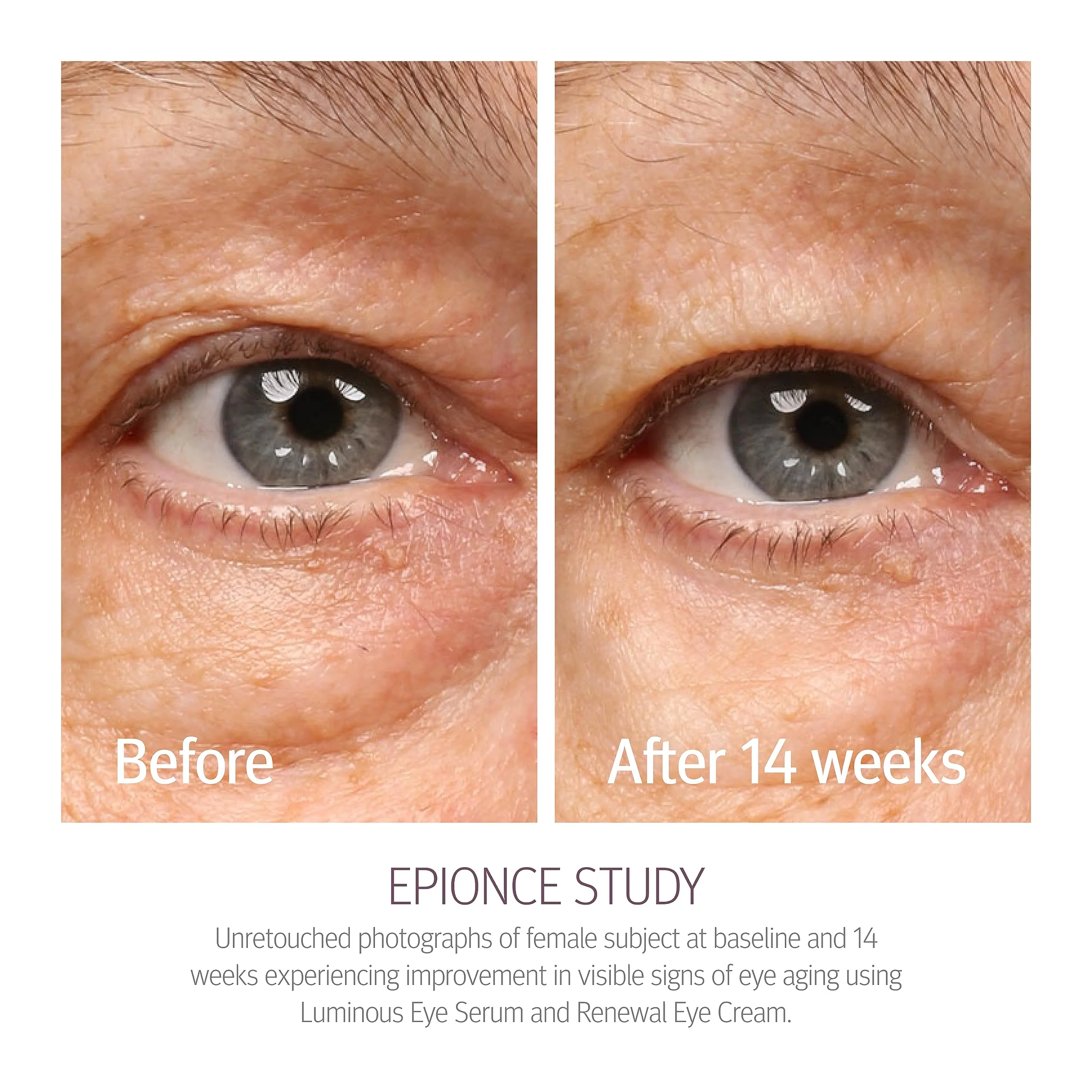 Epionce Renewal Eye Cream - Anti-Aging, Under Eye Cream for Dark Circles, Fine Lines, Wrinkles & Puffiness with Hyaluronic Acid, For All Skin Types, Dermatologist Skincare - Image 8