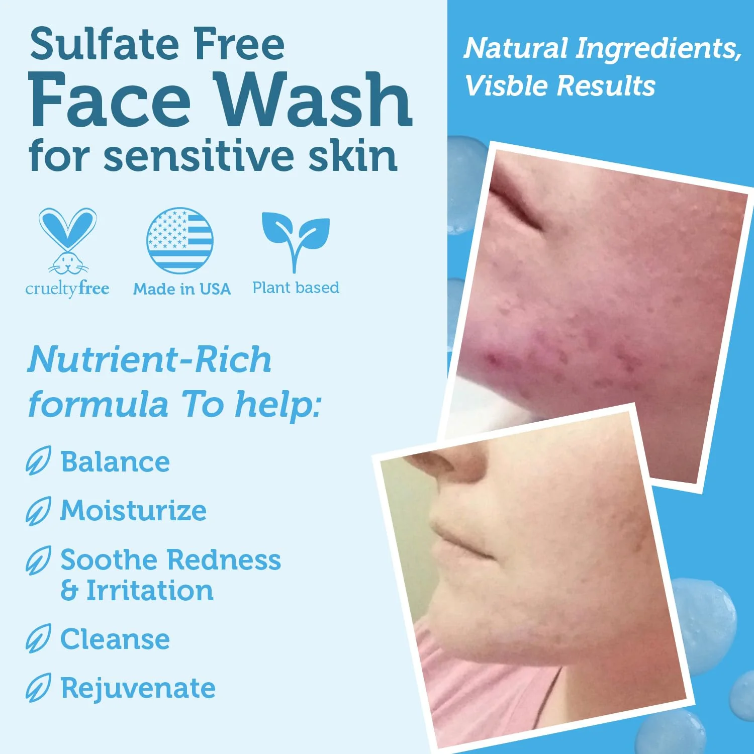 Era Organics Manuka Honey Face Wash for Sensitive Skin - Sulfate Free Gentle Cleanser with Organic Aloe Vera, Hyaluronic Acid & More - Soothing & Moisturizing for Dry Skin - Made in USA (8 oz) - Image 3