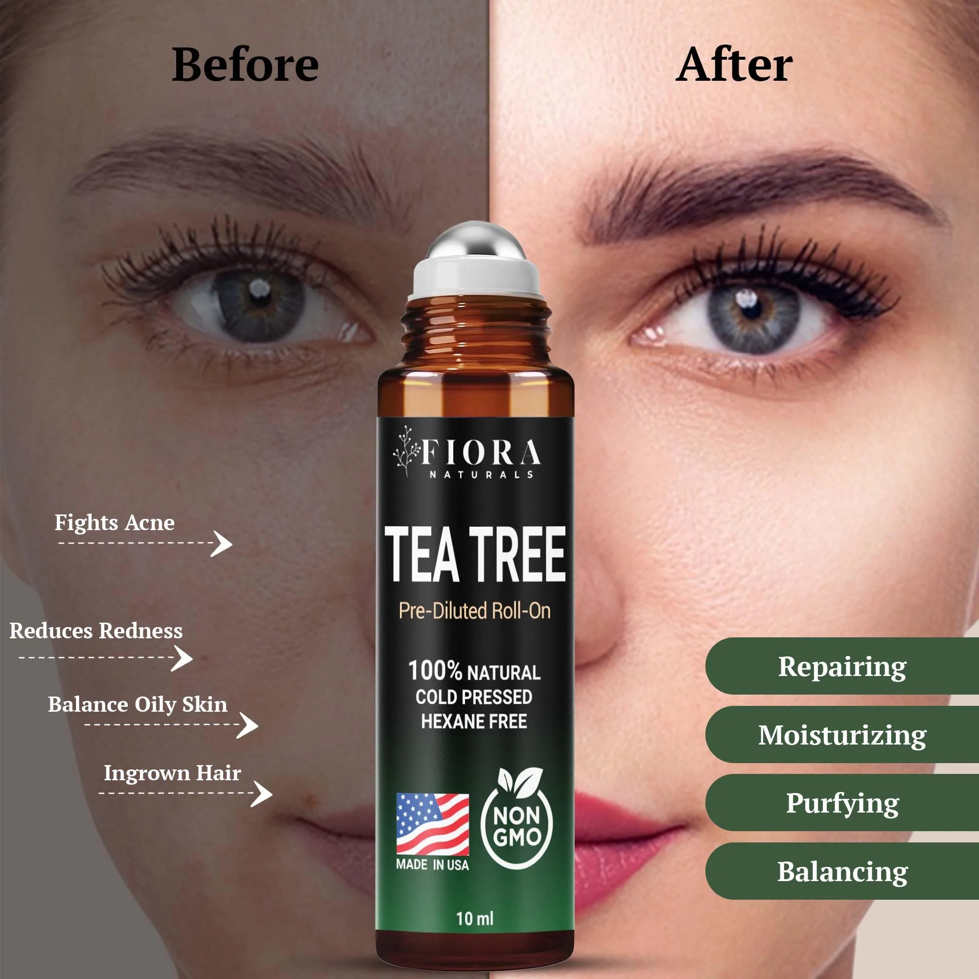 Fiora Naturals Tea Tree Oil Roll On - 100% Natural Tea Tree Essential Oil for Skin, Face, Acne, Nails, Cuticles, Scalp & Aromatherapy Wellness - Image 4