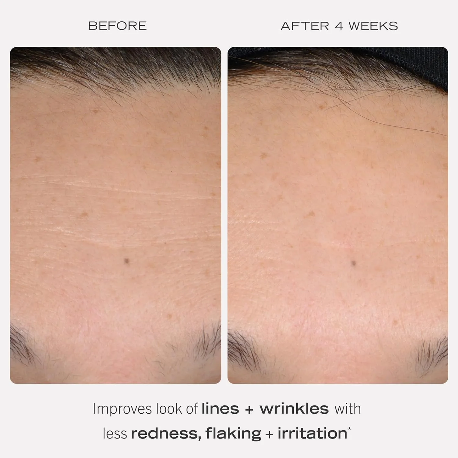 First Aid Beauty - 0.3% Retinol Complex Serum with Peptides, Designed for Sensitive Skin, Helps Visibly Improve Lines and Wrinkles with Less Irritation than Traditional Retinol, Non-Comedogenic, 1 oz - Image 8