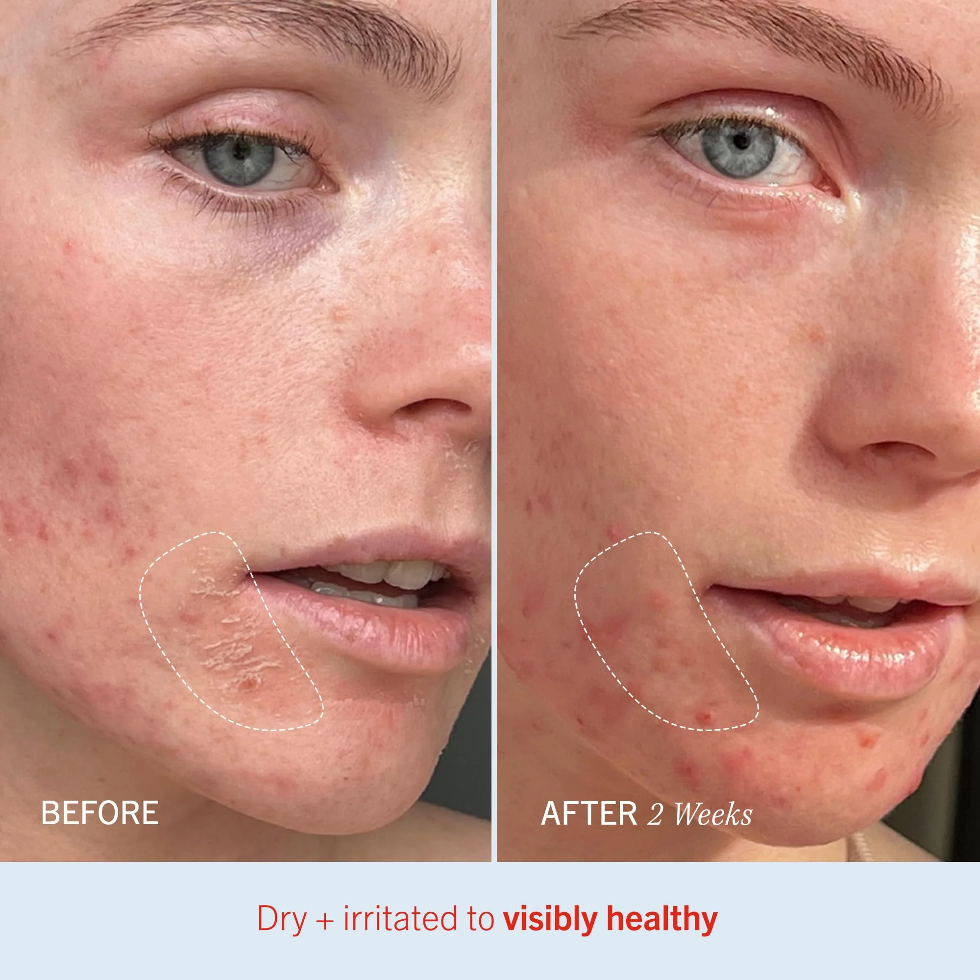 First Aid Beauty - Ultra Repair Cream, Intense Hydration Whipped Colloidal Oatmeal, Strengthens Skin Barrier in 7 Days & Helps Relieve Eczema, Luxury Face & Body Moisturizer, Grapefruit Scent, 12 oz - Image 4