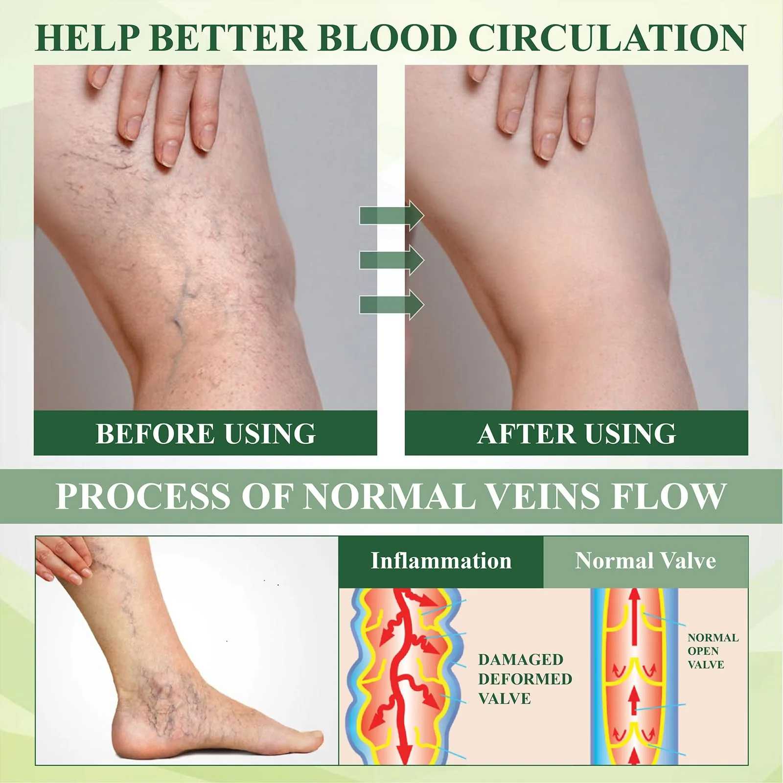 Fluidease Leg Therapy Edema Cream, Fluid Ease Leg Therapy Cream, Lymphatic Drainage Massage Cream, Swell Care Lymphatic Massage Cream, Edema Relief for Legs and Feet (1) - Image 4