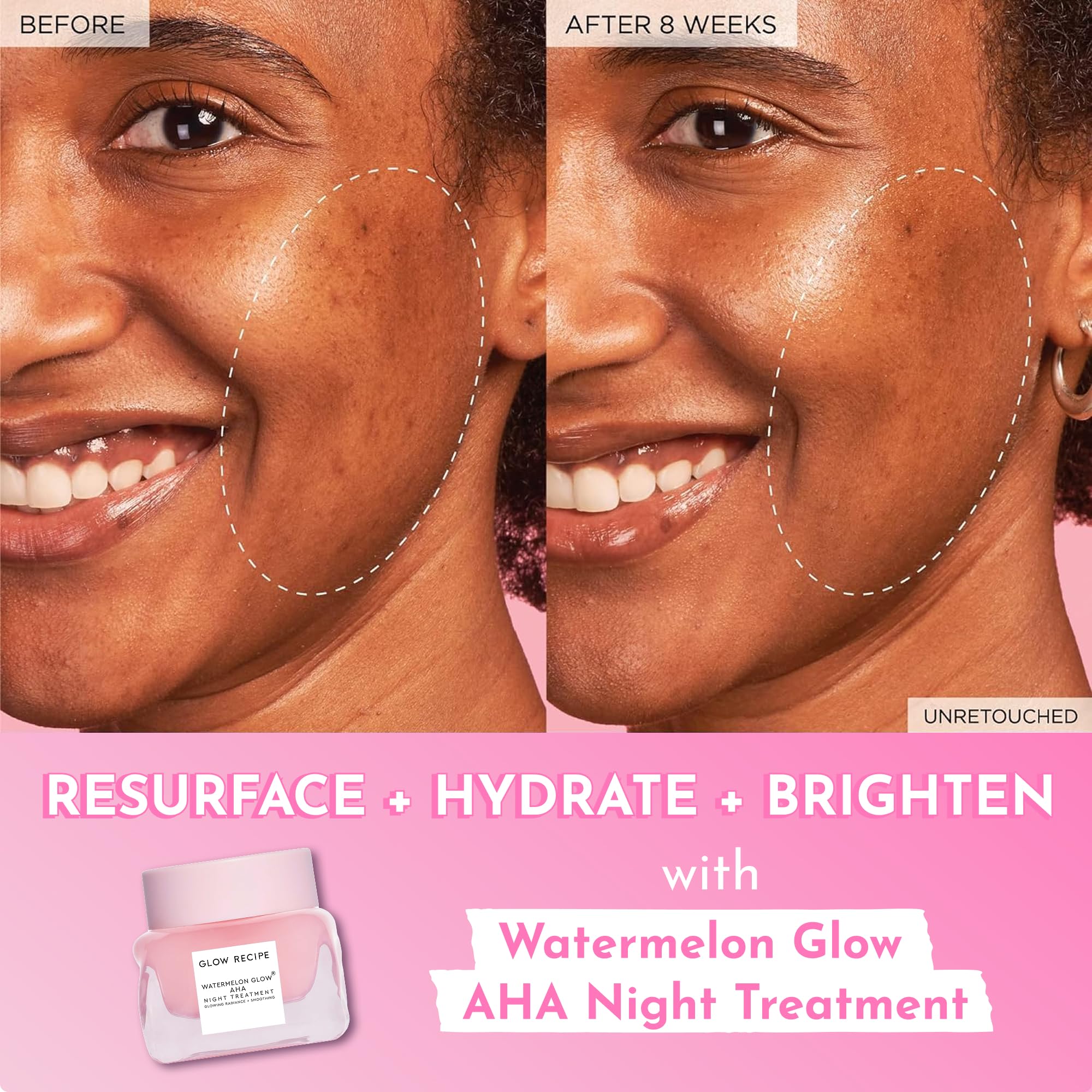 Glow Recipe Watermelon Glow AHA Night Treatment - Overnight Resurfacing Mask with AHA Complex, Hyaluronic Acid, Niacinamide & Watermelon Enzymes for Smooth, Glowing, Even-Toned Skin (60ml) - Image 8